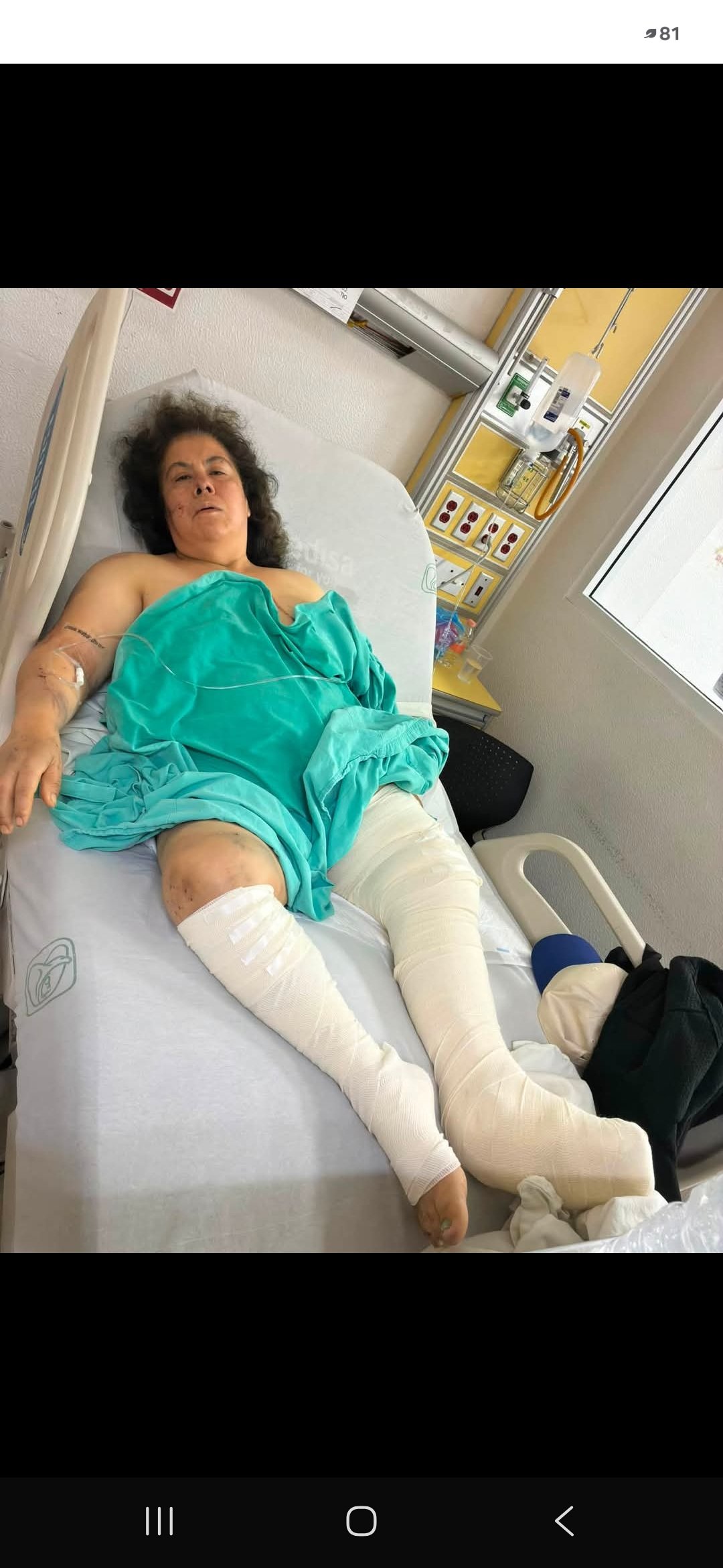Help Lorena (of El Jordan) recover and cover hospital bills campaign photo, 4 of 5