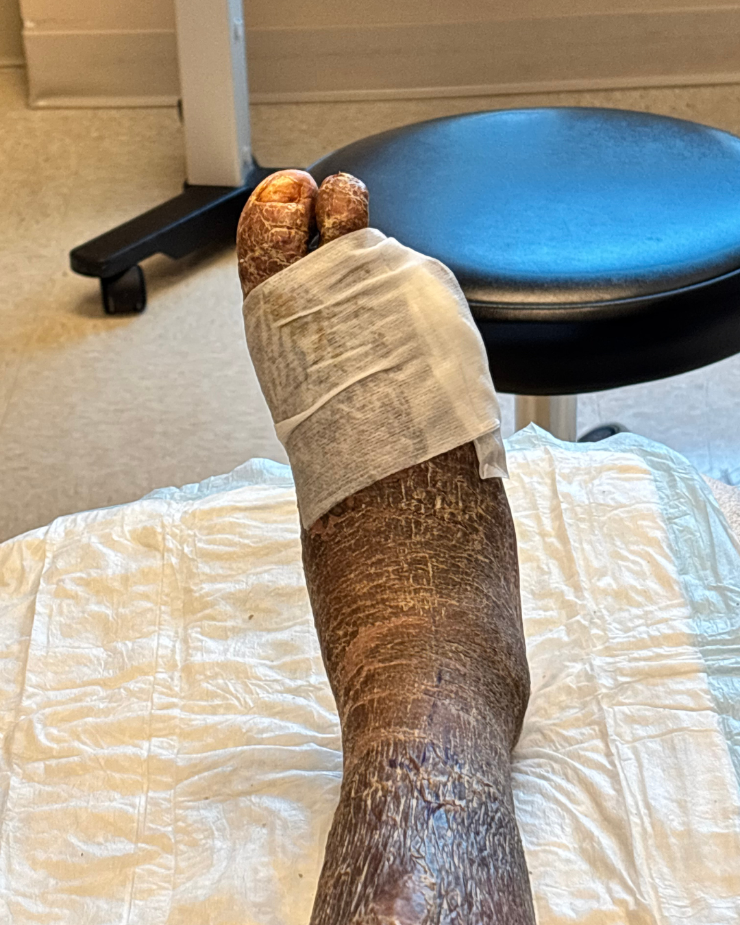 Amputation Recovery & Electric Hospital Bed for Carlos❤️ campaign photo, 4 of 7