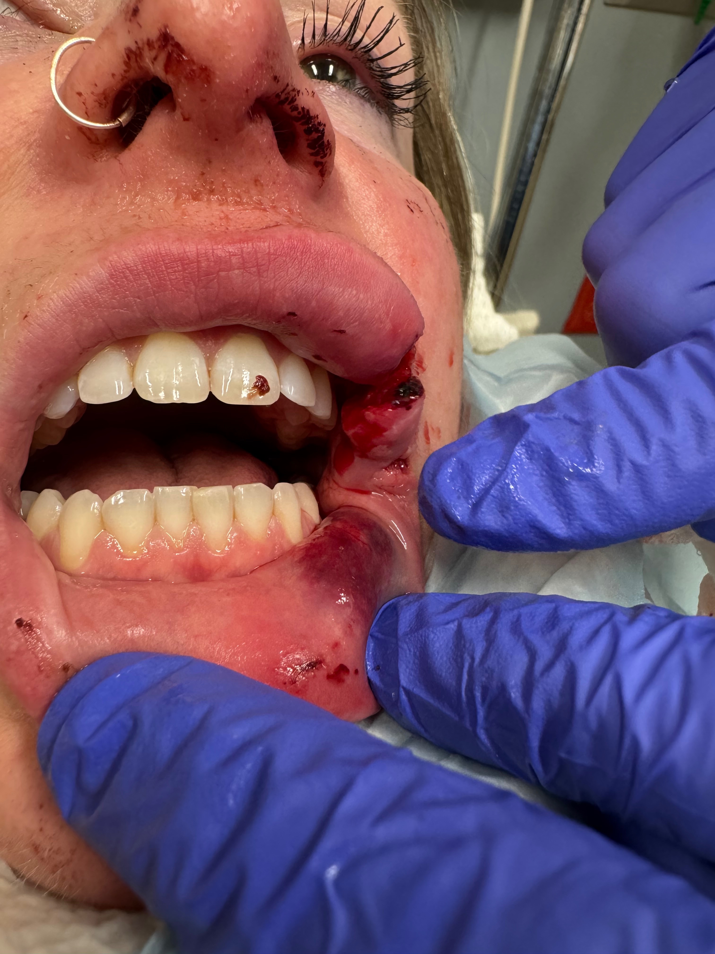 Help Celia Heal After Traumatic Attack campaign photo, 7 of 8