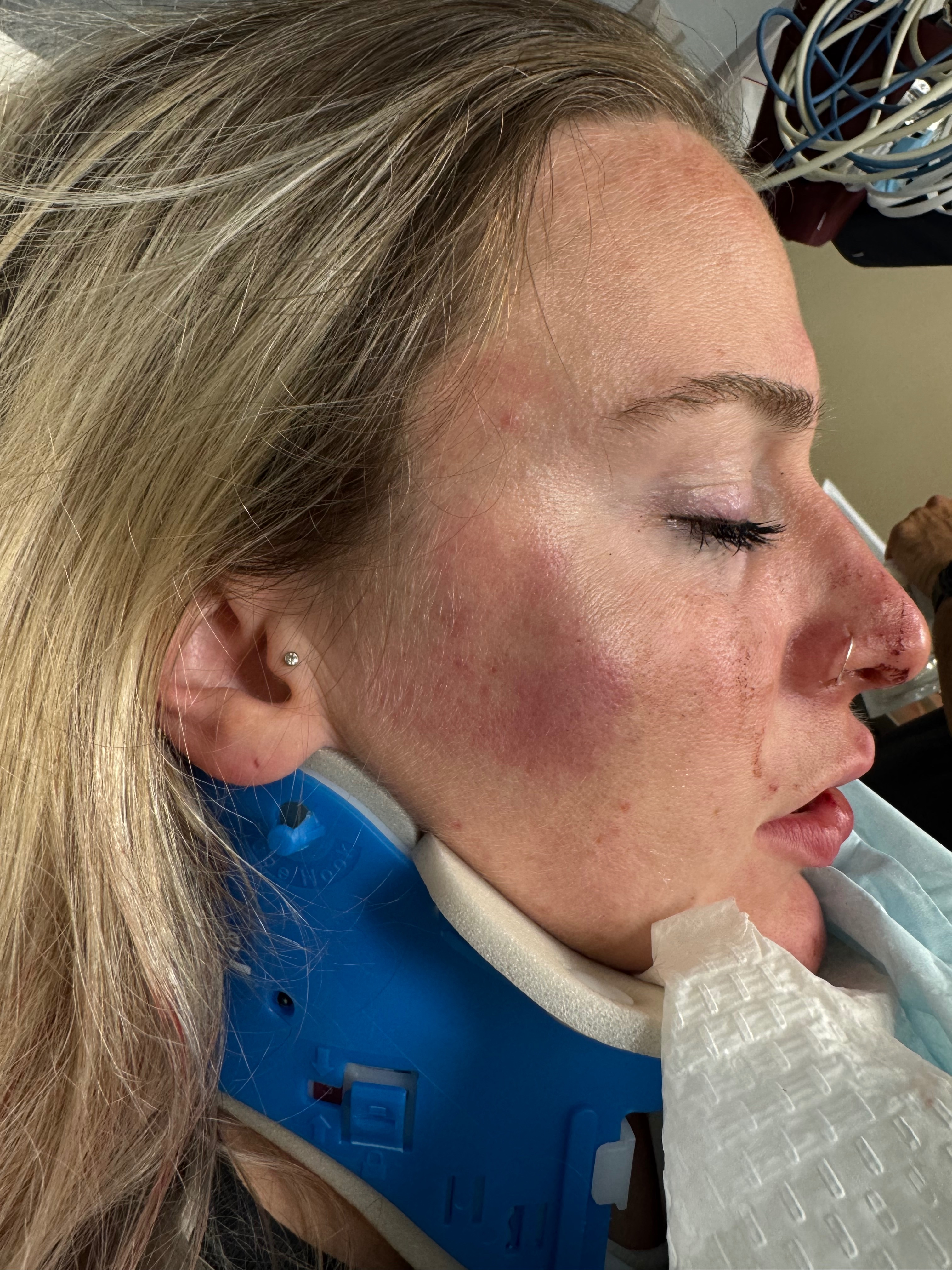 Help Celia Heal After Traumatic Attack campaign photo, 4 of 8