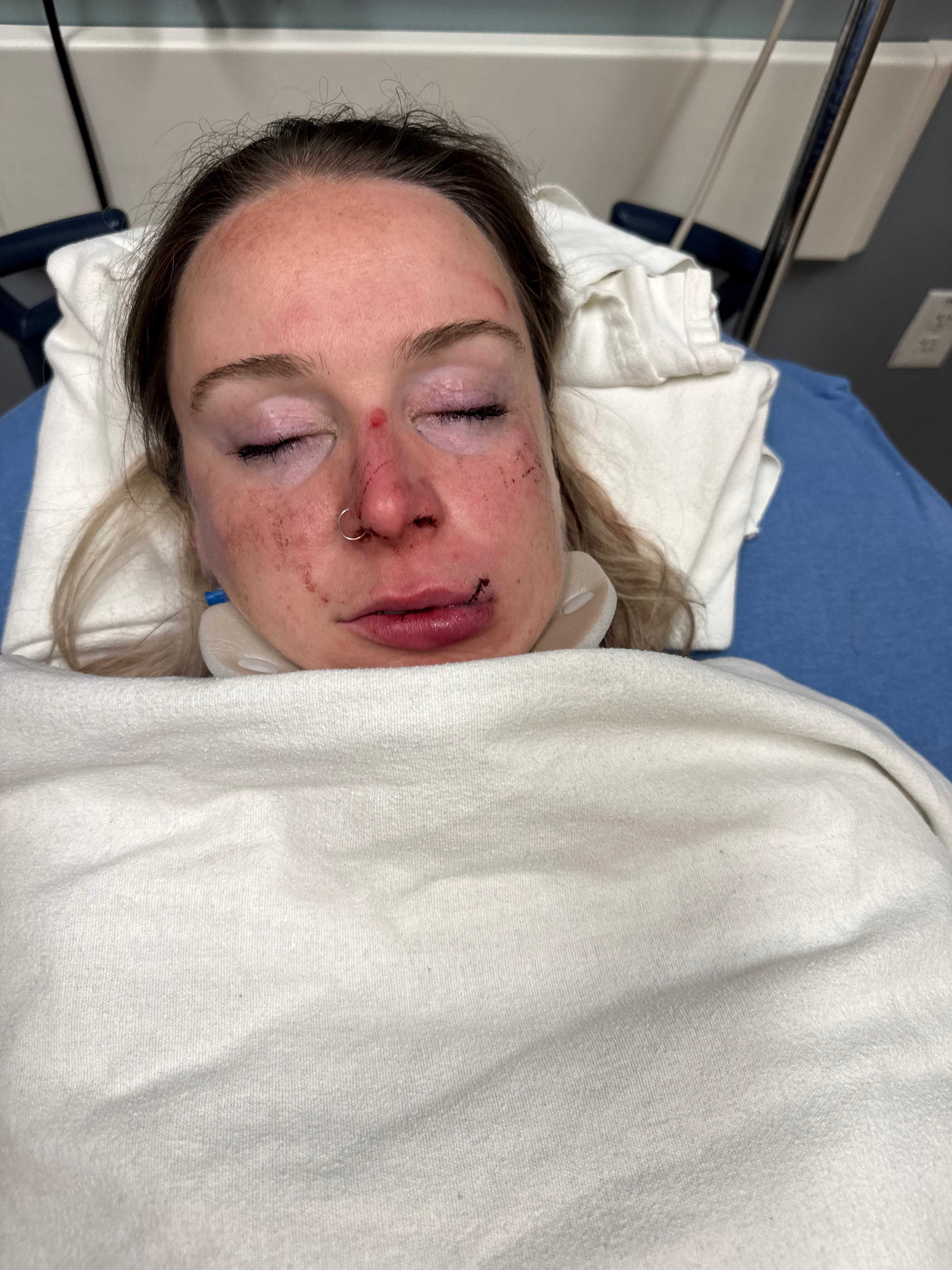 Help Celia Heal After Traumatic Attack campaign photo, 5 of 8