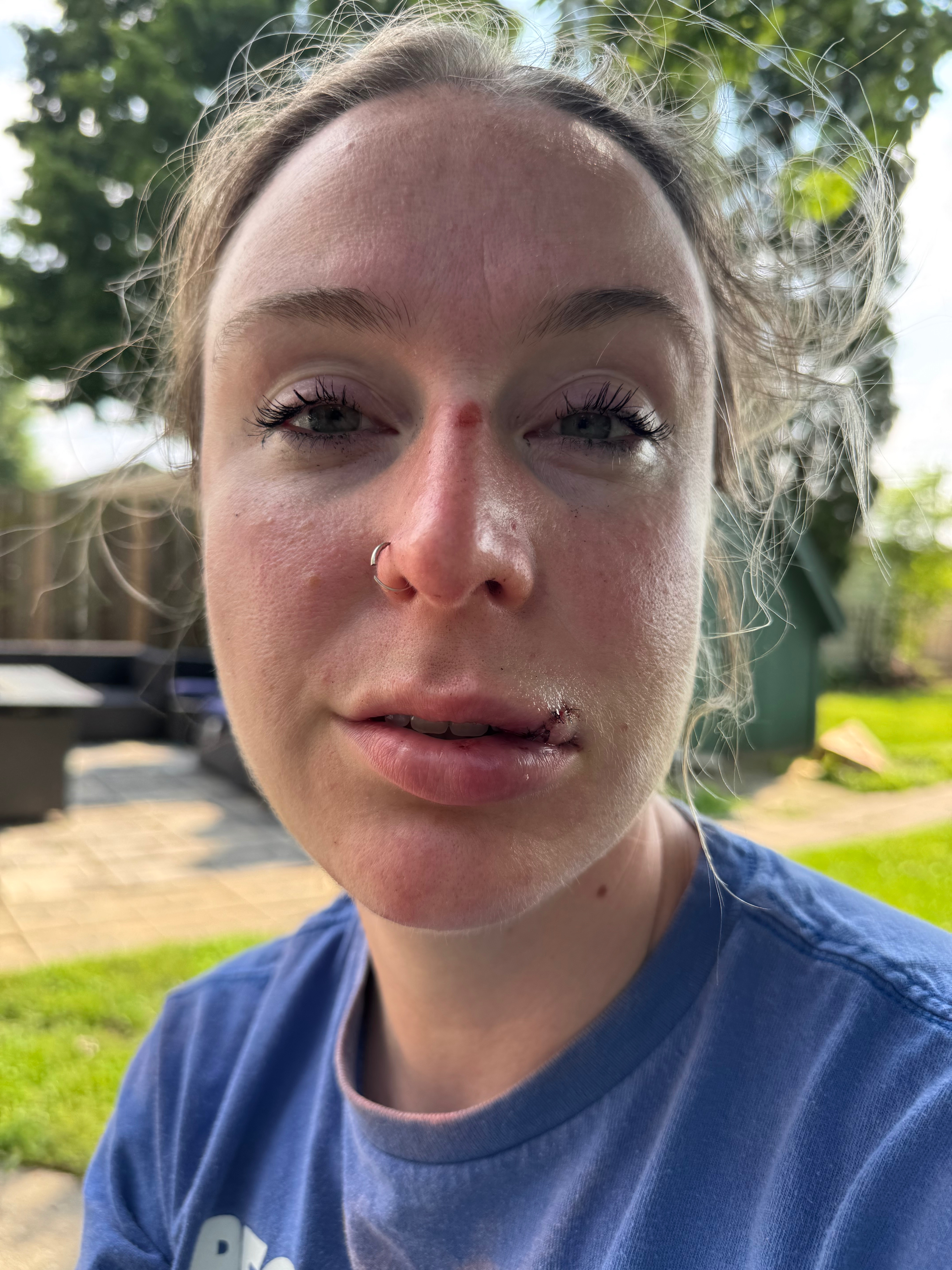 Help Celia Heal After Traumatic Attack campaign photo, 6 of 8