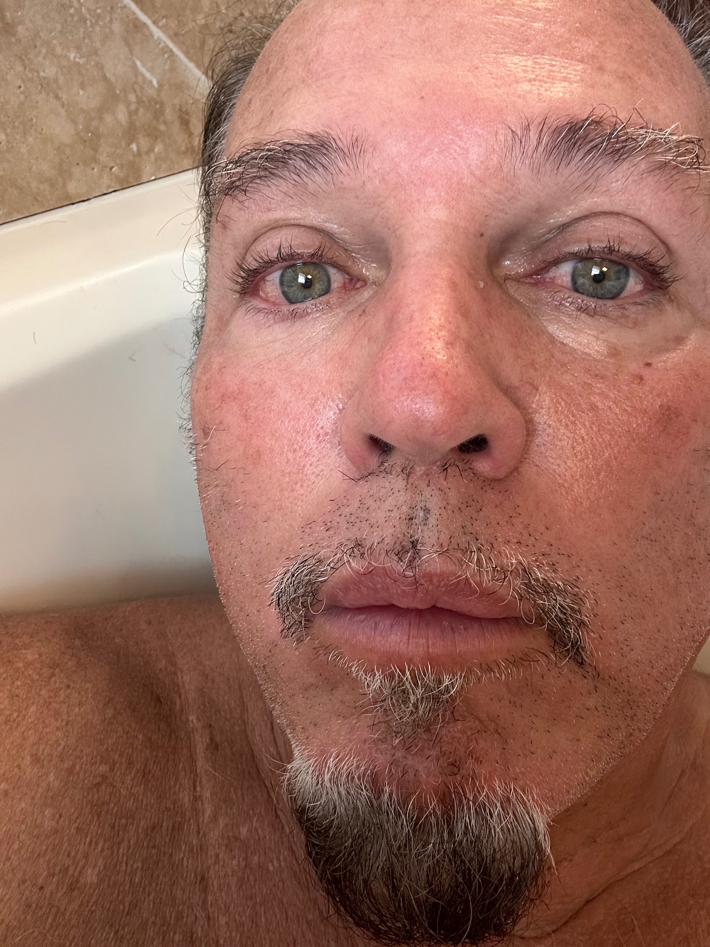 Help Ron Williams Access Life-Saving Sjögren's Treatment campaign photo, 5 of 8