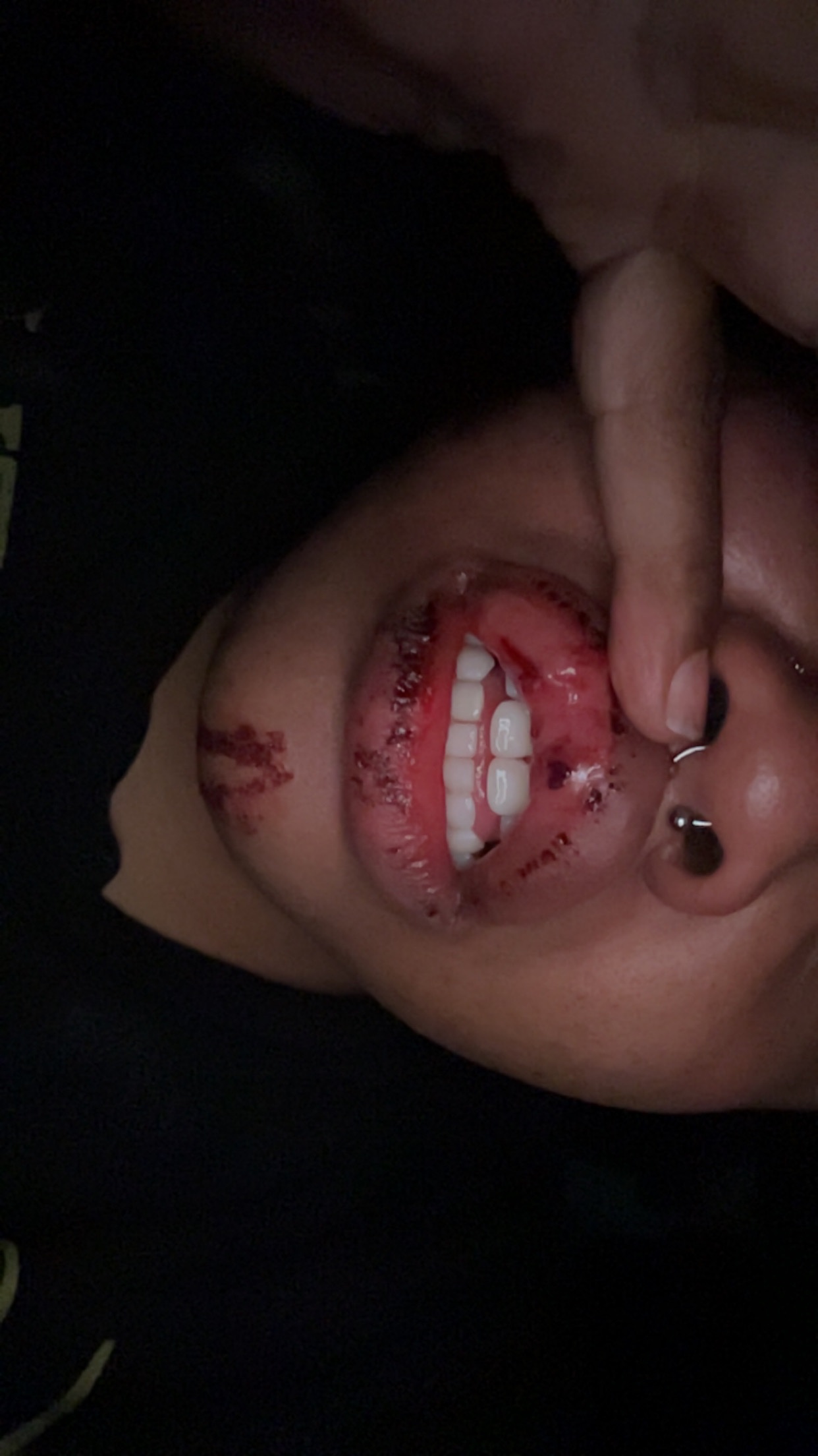 Help Me Recover After a Violent Assault campaign photo, 7 of 8