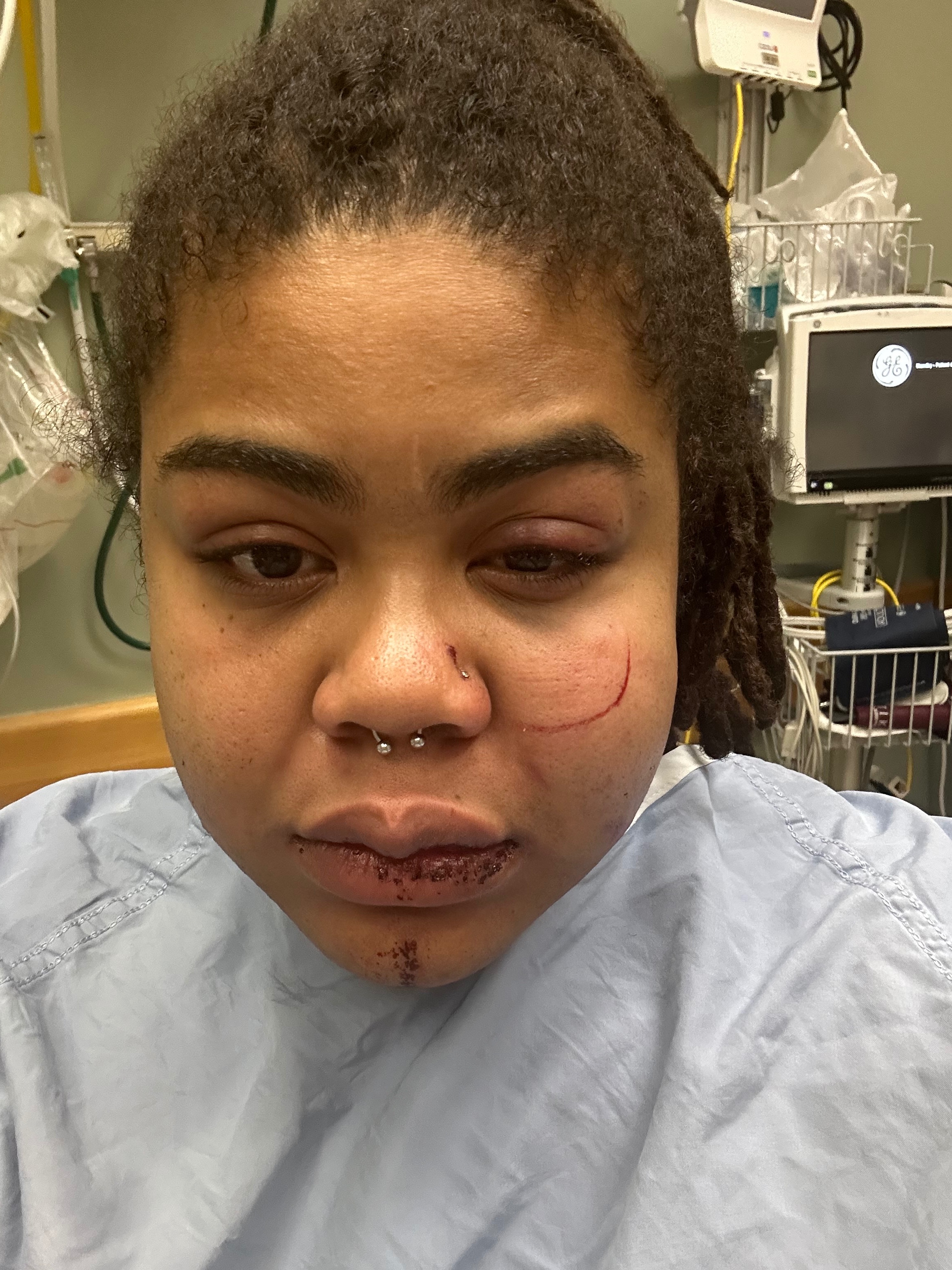 Help Me Recover After a Violent Assault campaign photo, 2 of 8