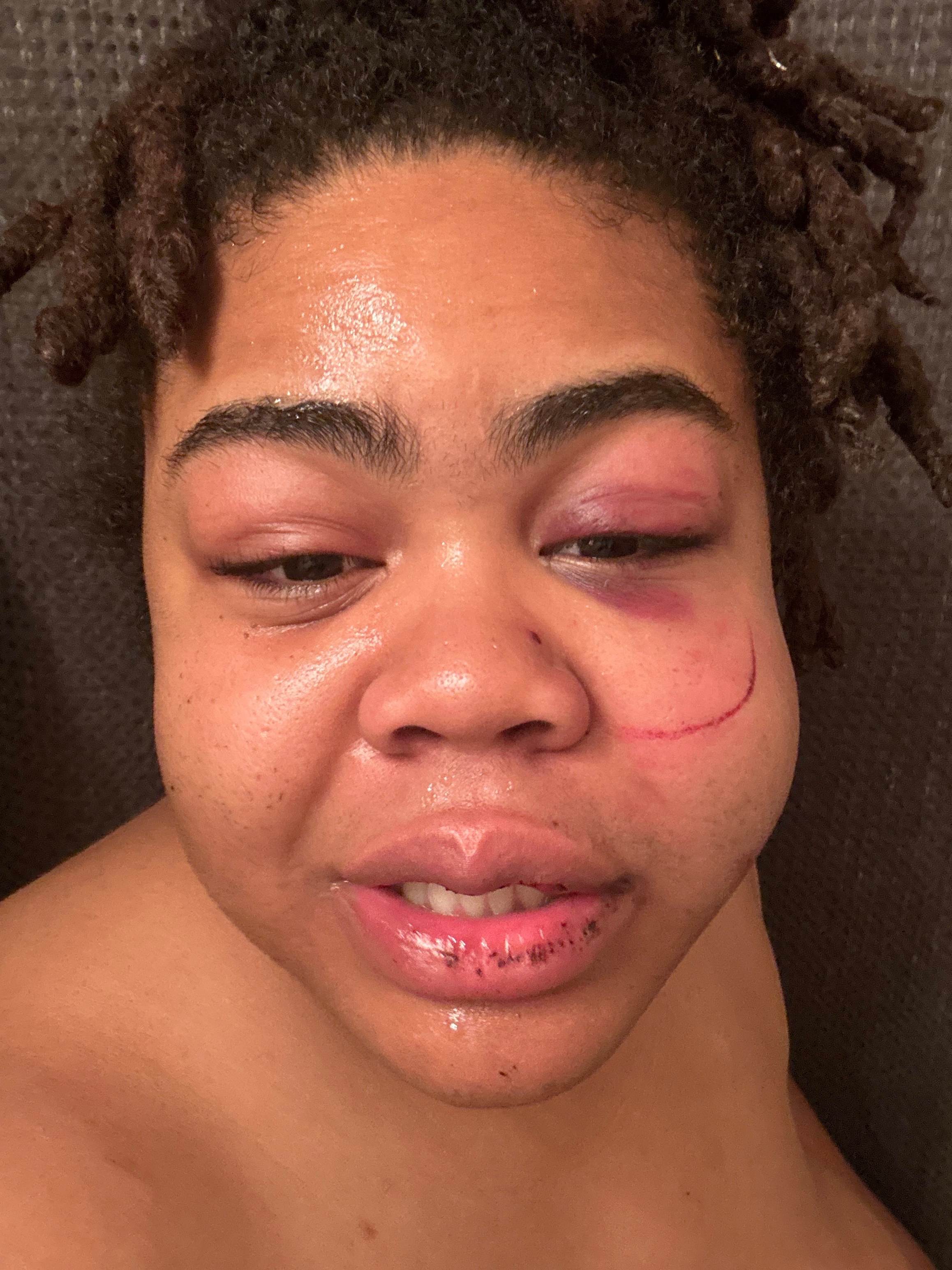 Help Me Recover After a Violent Assault campaign photo, 4 of 8