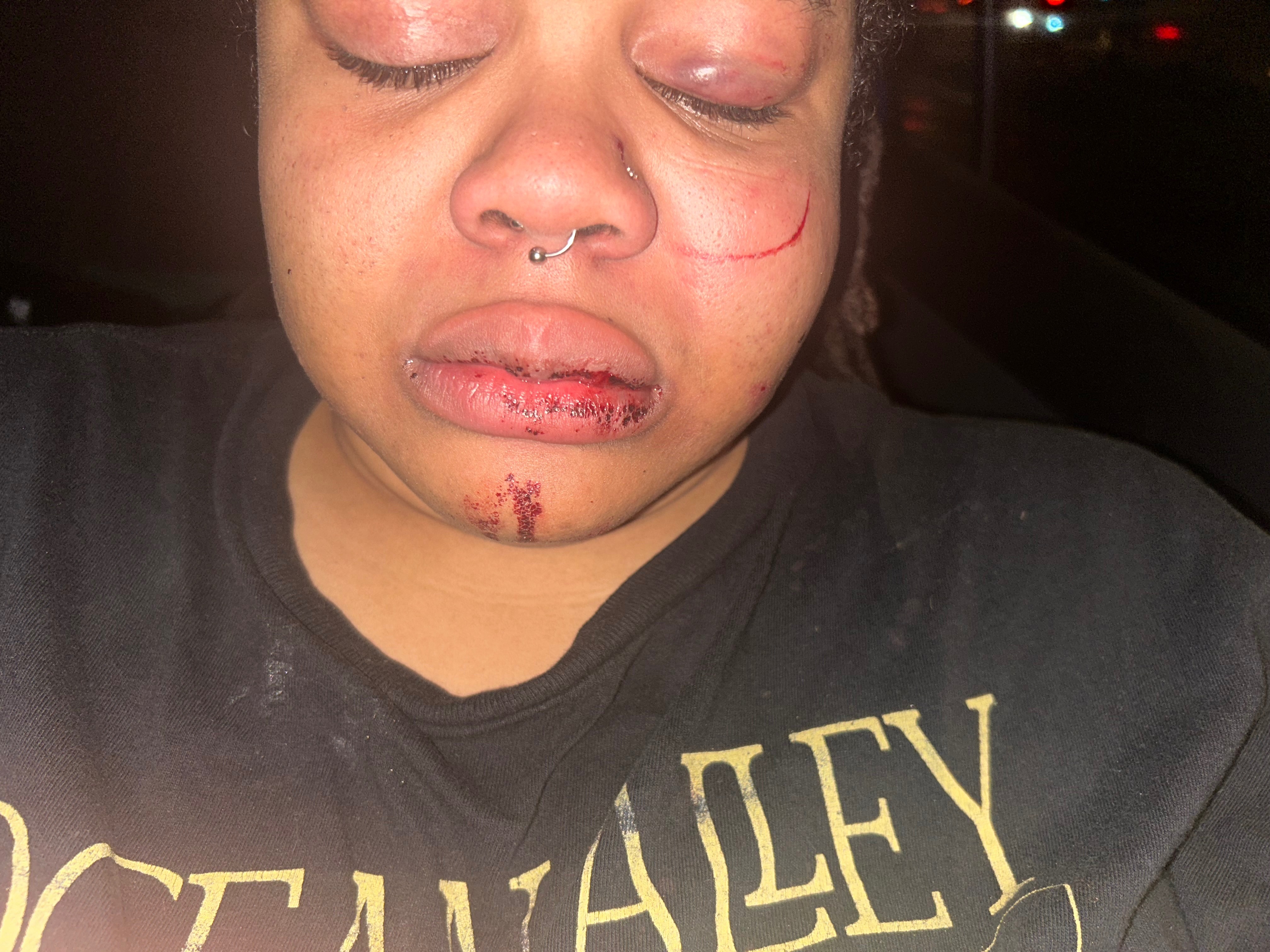 Help Me Recover After a Violent Assault campaign photo, 5 of 8