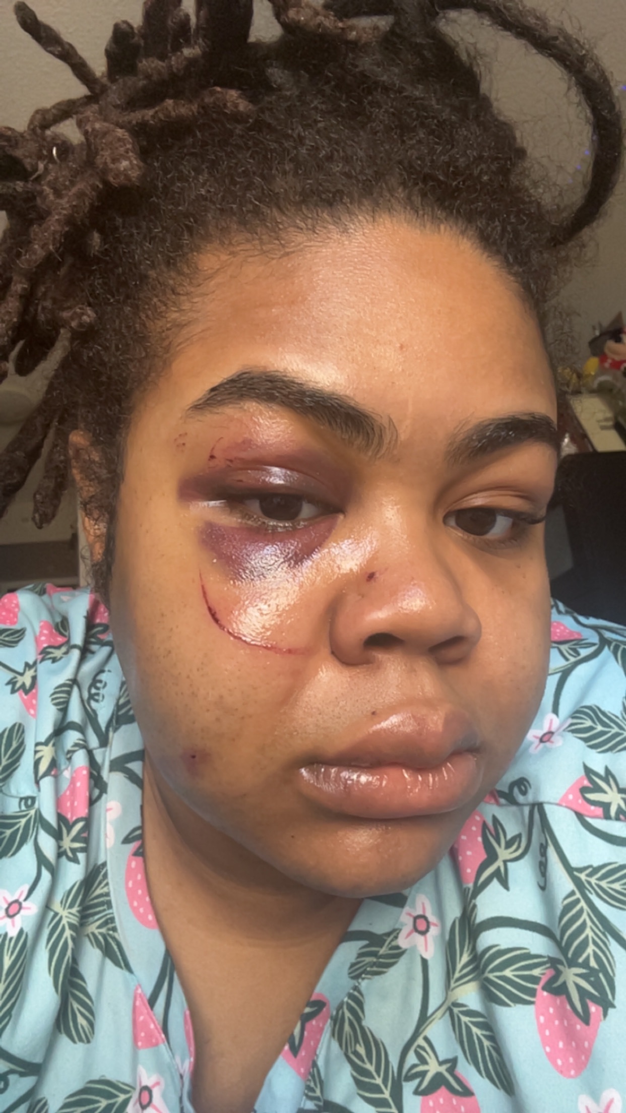 Help Me Recover After a Violent Assault campaign photo, 6 of 8