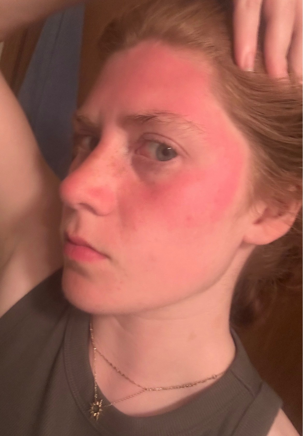 Help Lexi Manage Mast Cell Activation Syndrome campaign photo, 5 of 8