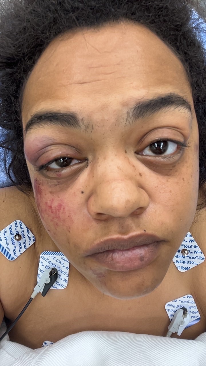 Foto van campagne Support Mariah Curry’s Recovery, 2 van 7