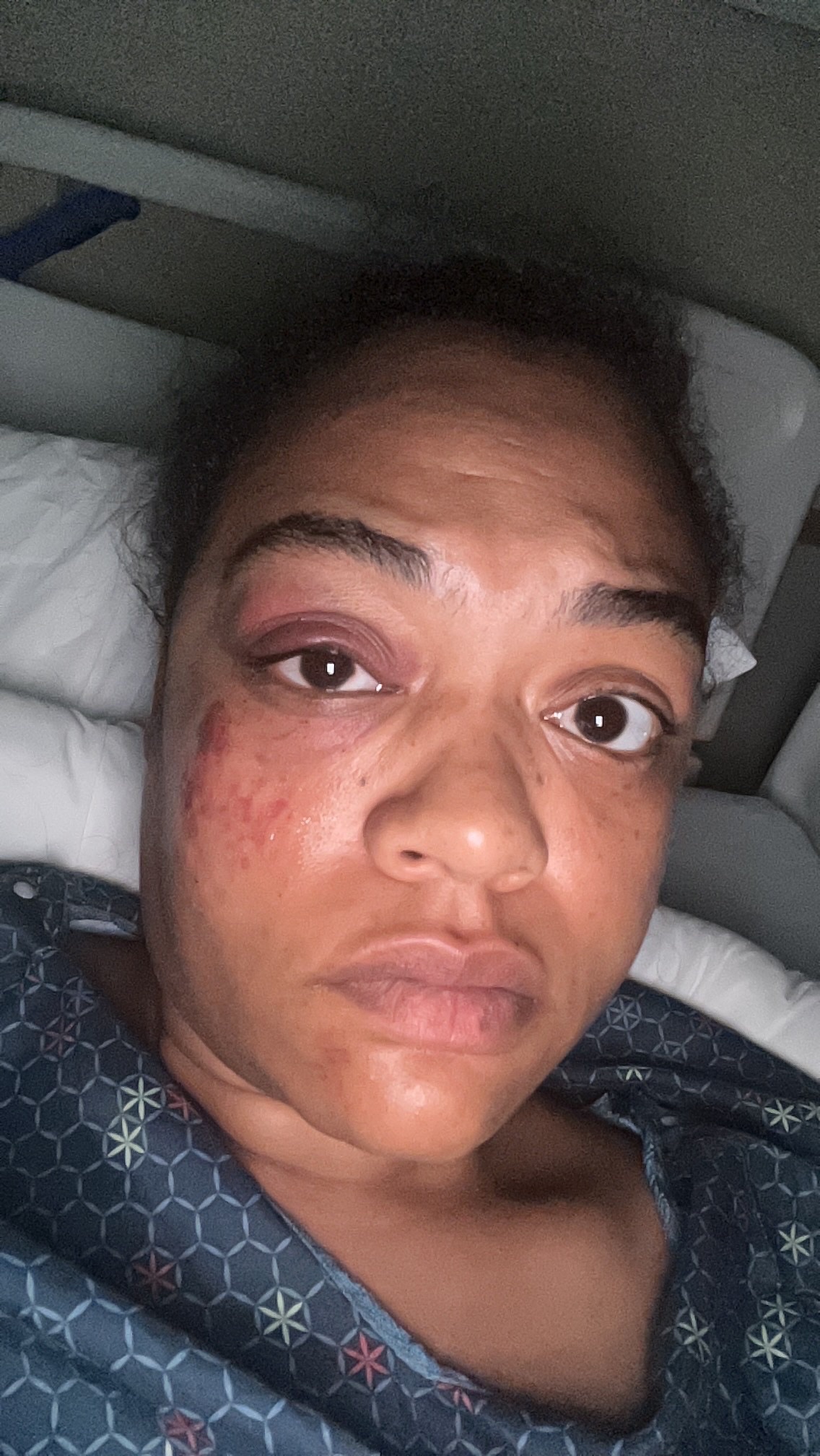 Foto van campagne Support Mariah Curry’s Recovery, 4 van 7