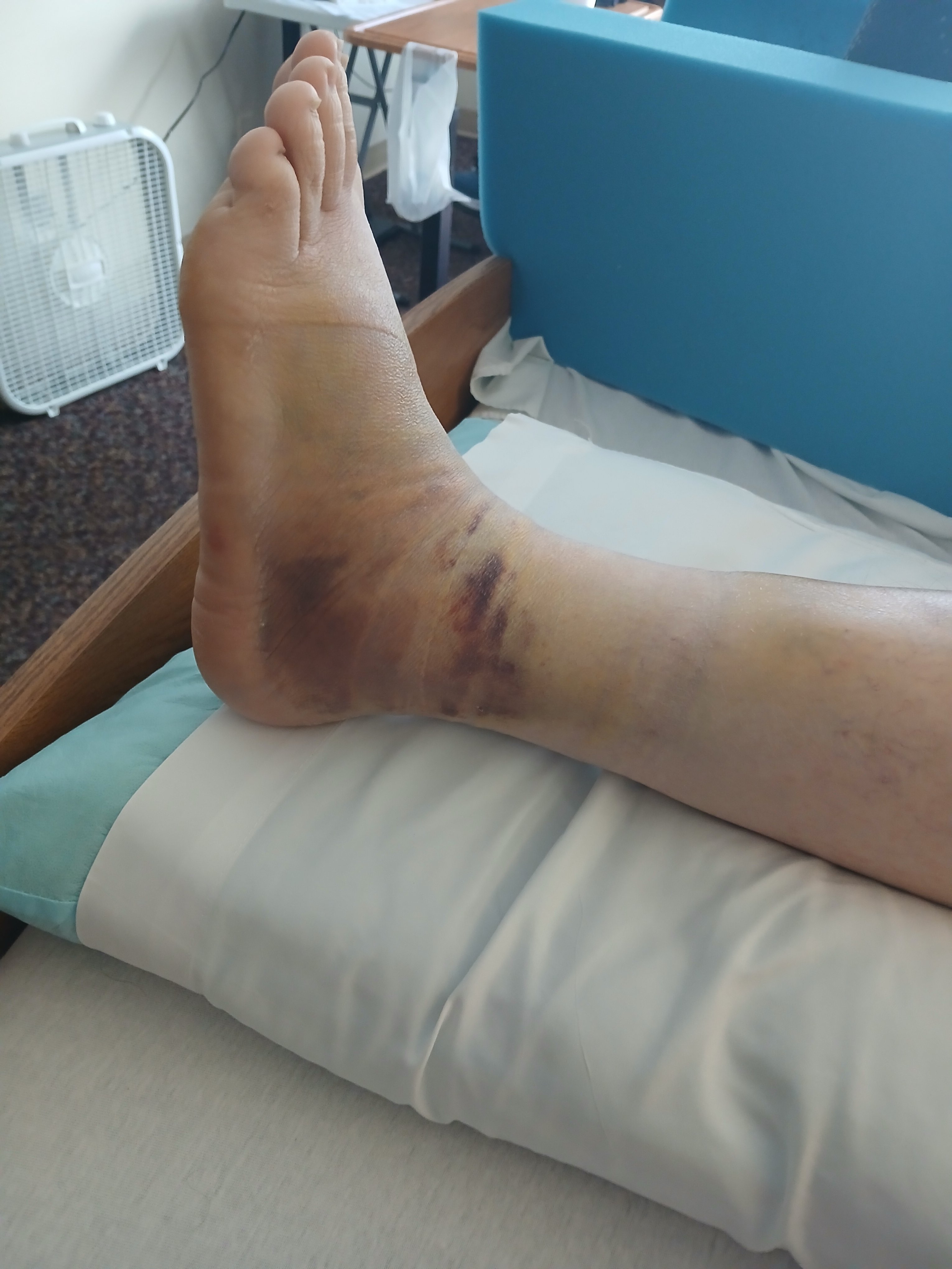 Help Me Recover After Being Hit by a Truck campaign photo, 4 of 5