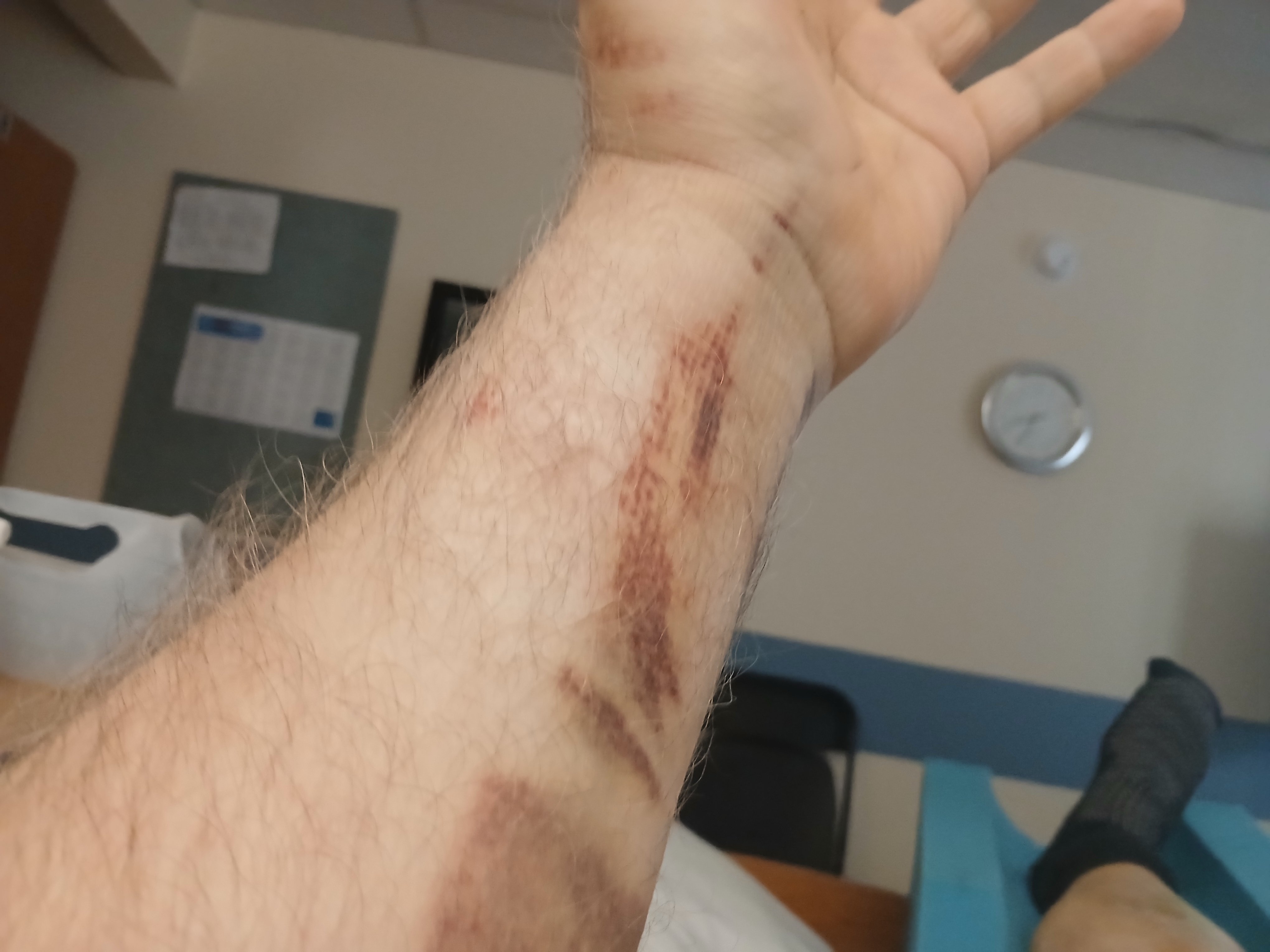 Help Me Recover After Being Hit by a Truck campaign photo, 2 of 5