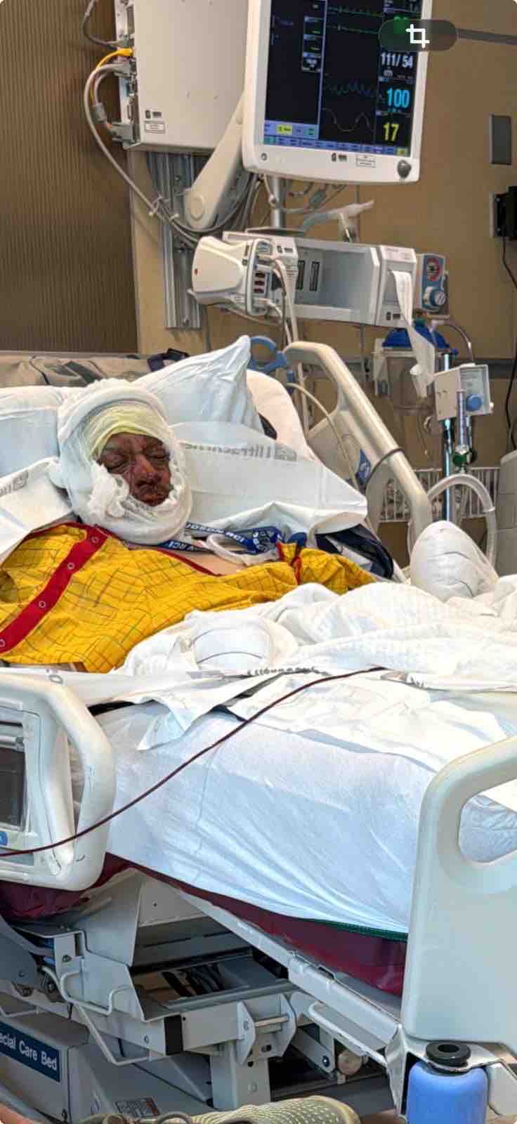 Support Fabian’s Recovery After the Fire campaign photo, 2 of 5