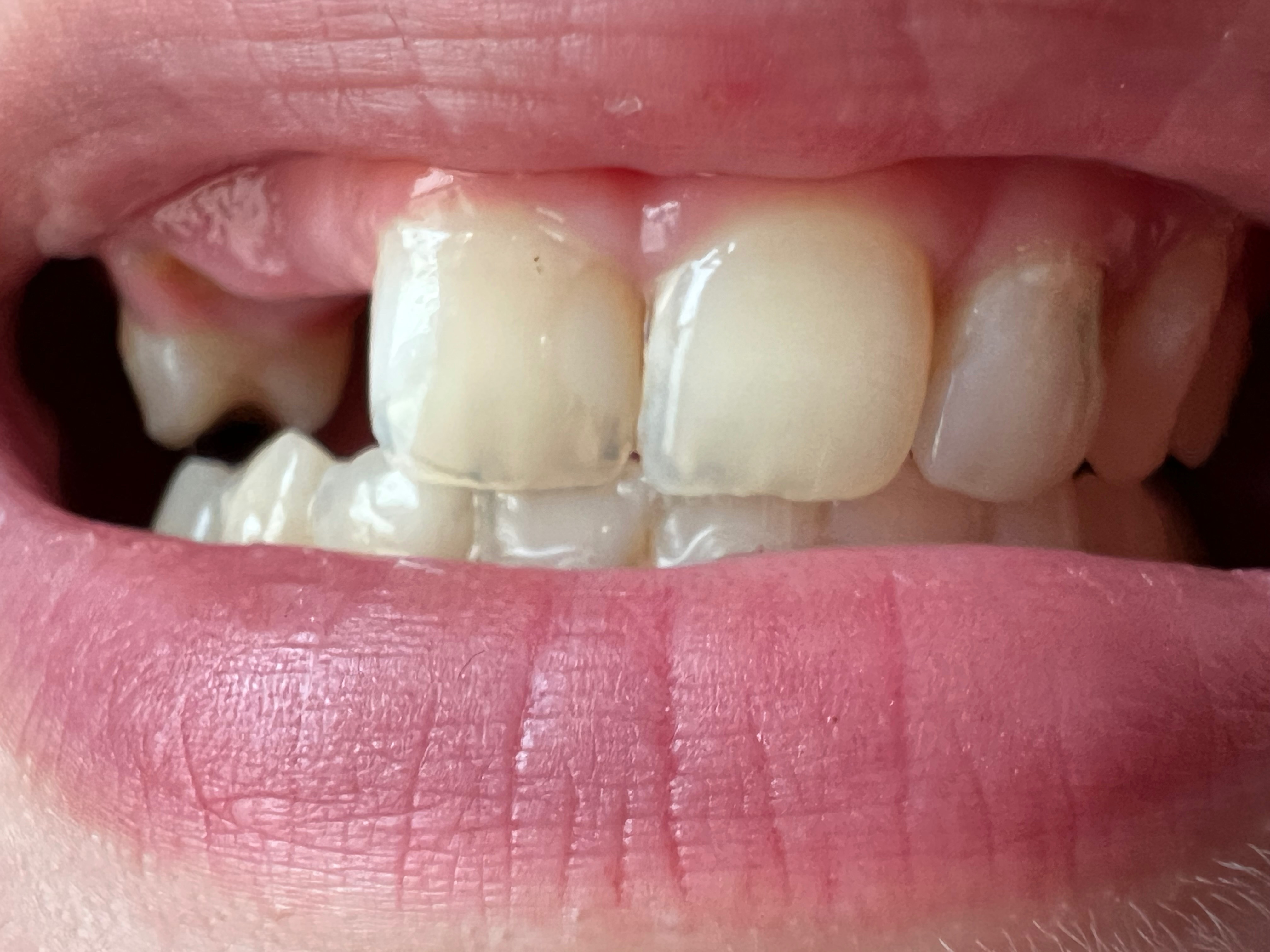 Support Karlee's Journey to Dental Health campaign photo, 2 of 6