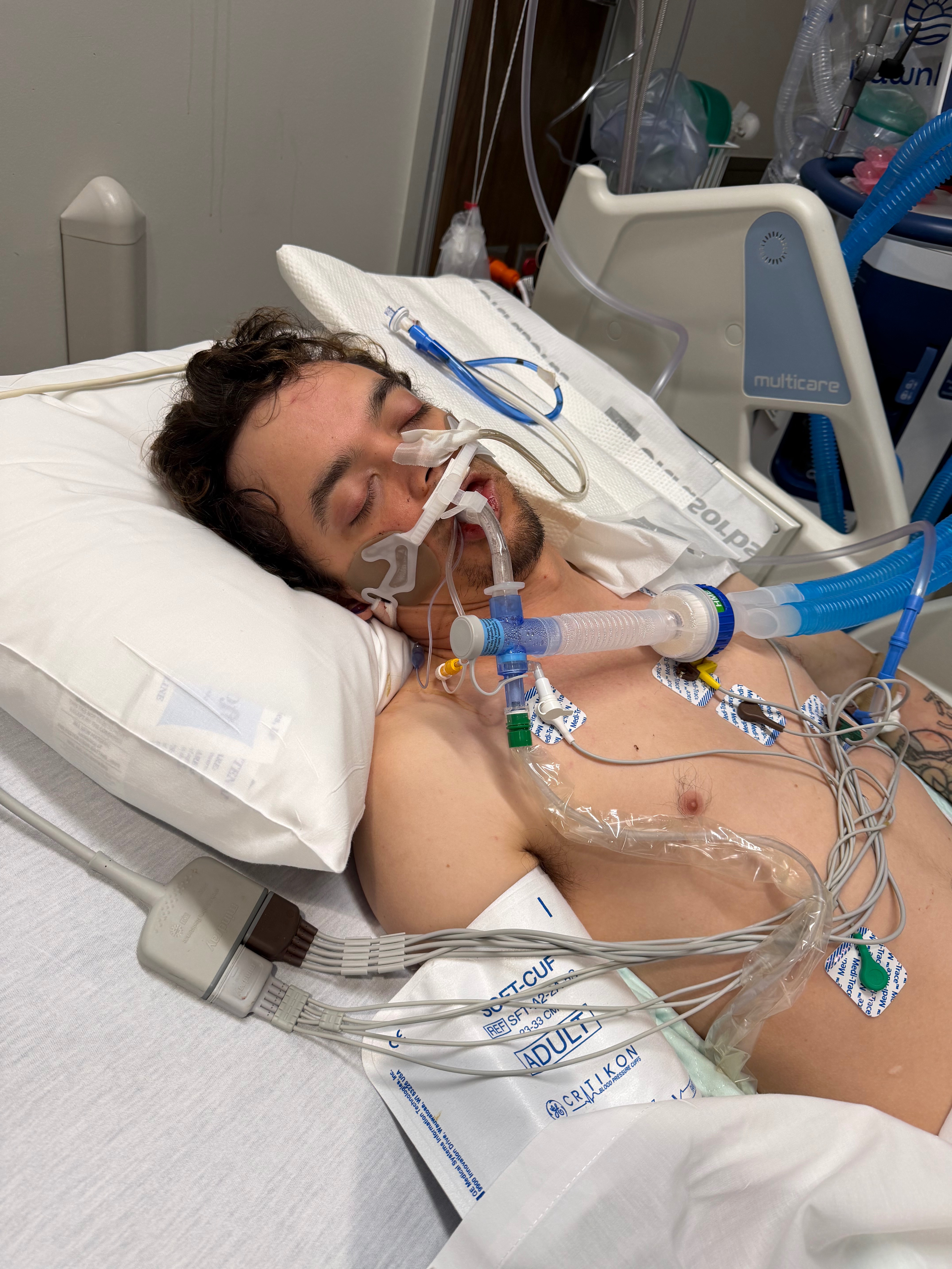 Joe’s Recovery after Severe Seizures & Memory Impairment campaign photo, 5 of 8