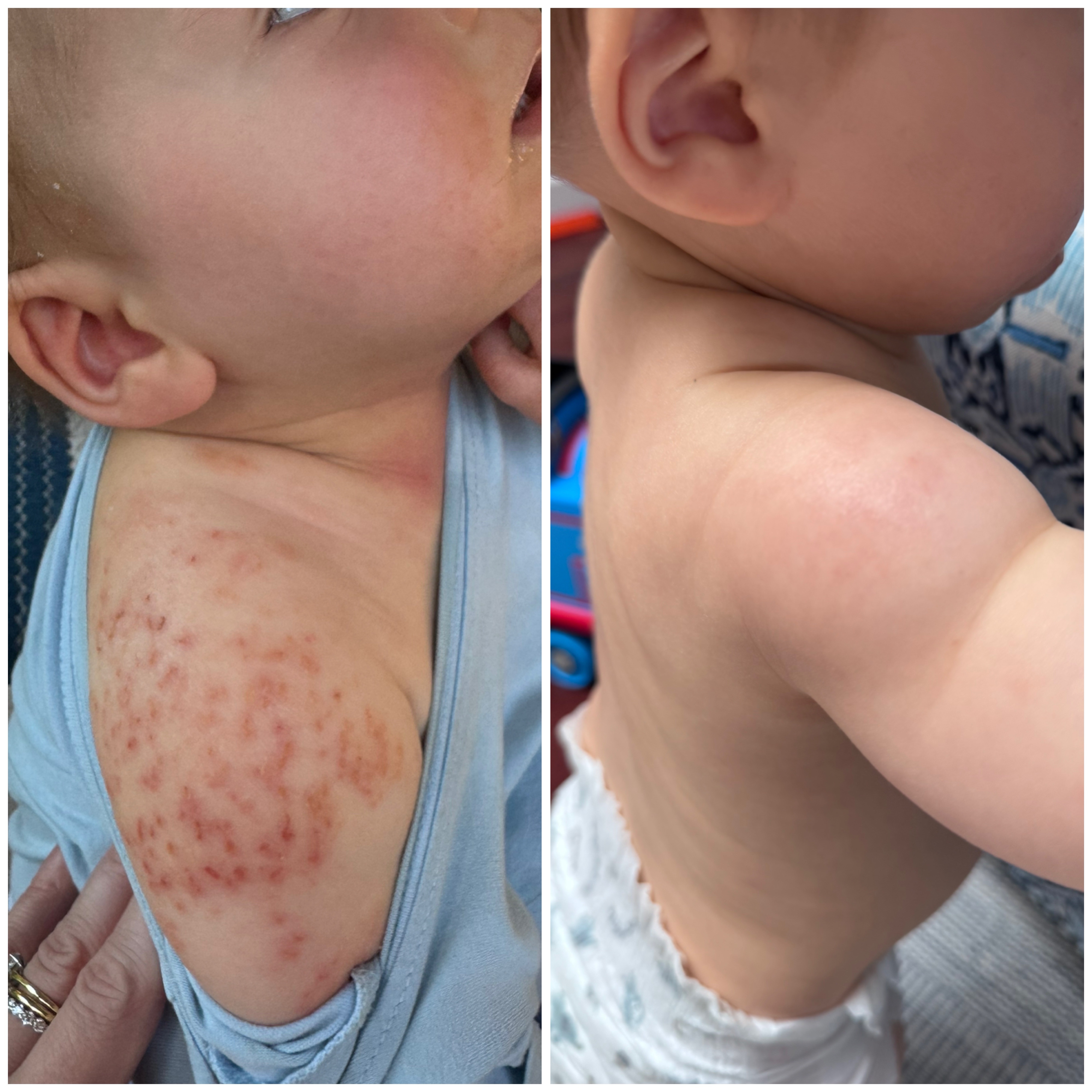 Help Carly & Shea Rebuild After Toxic Mold campaign photo, 5 of 6