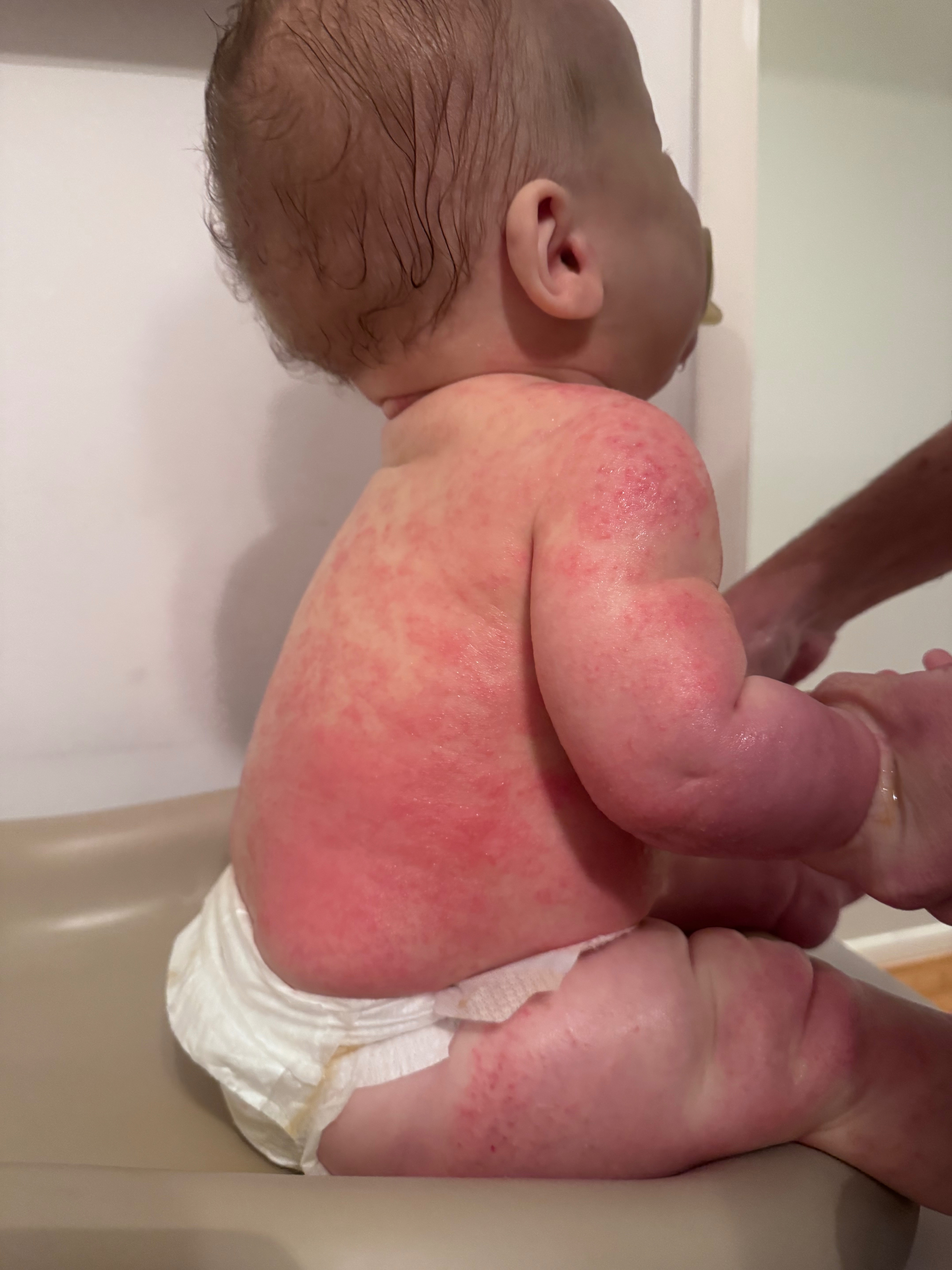 Help Carly & Shea Rebuild After Toxic Mold campaign photo, 2 of 6