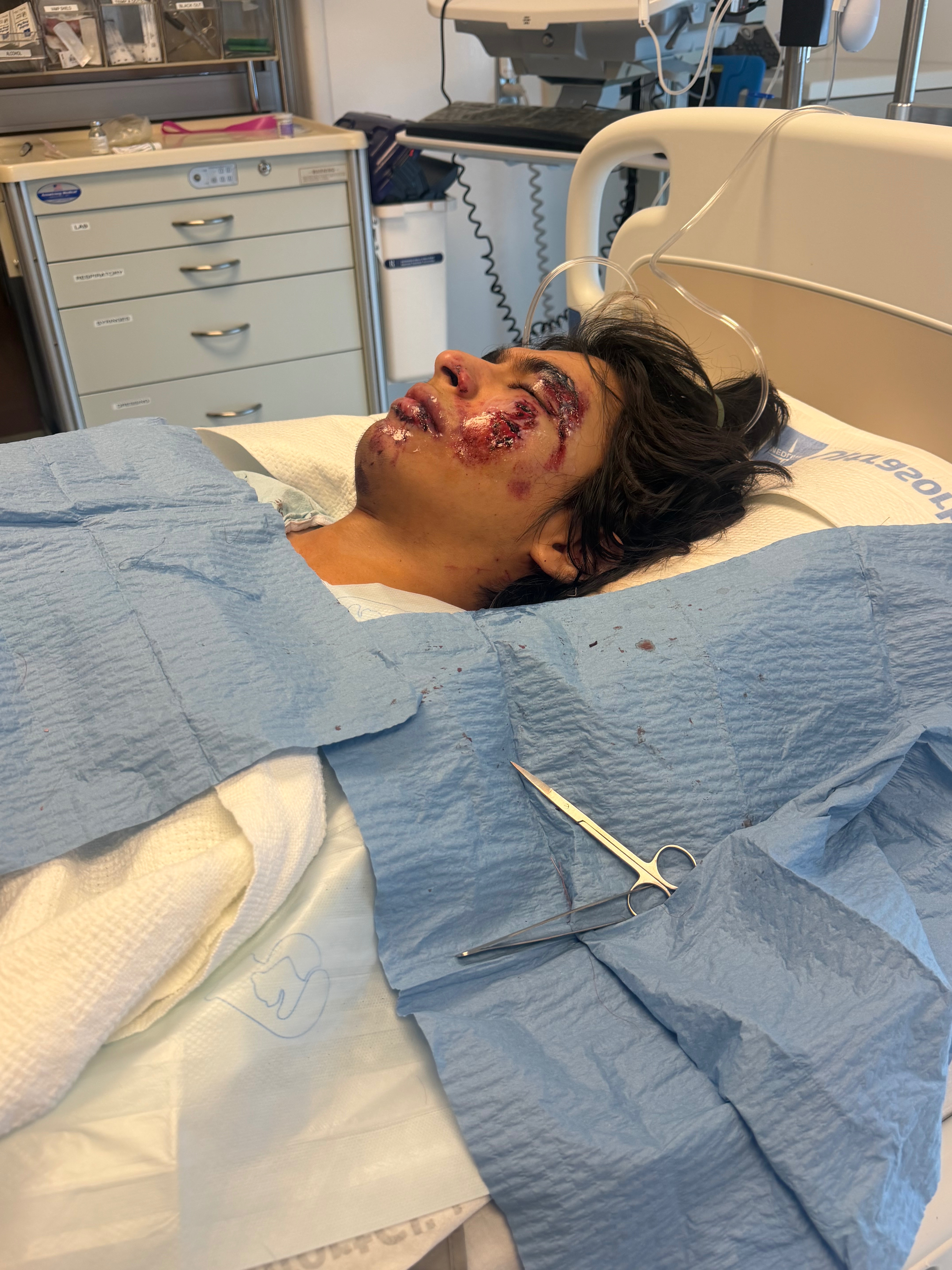Support Brandon Mendez's Recovery campaign photo, 2 of 8
