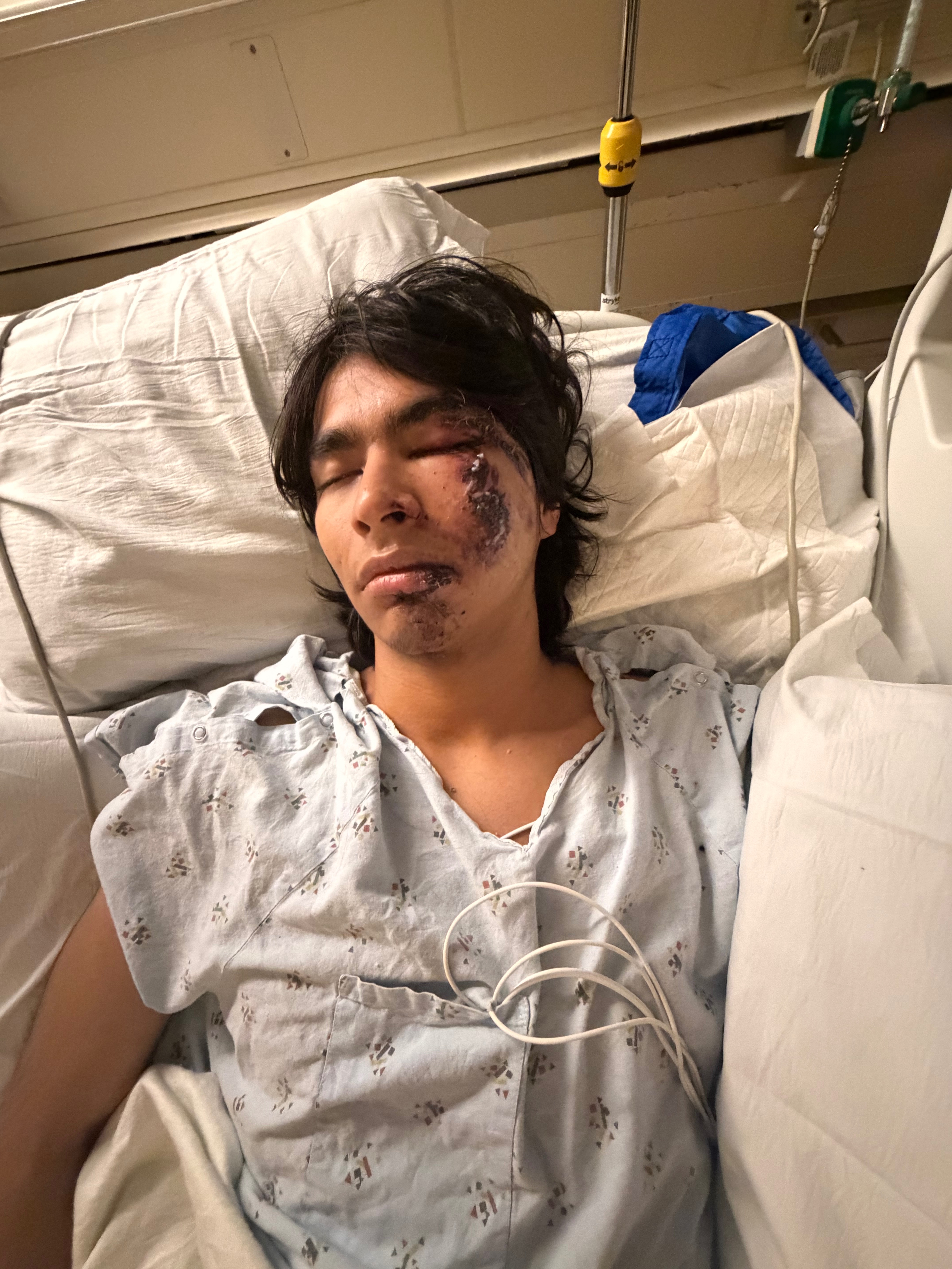 Support Brandon Mendez's Recovery campaign photo, 5 of 8