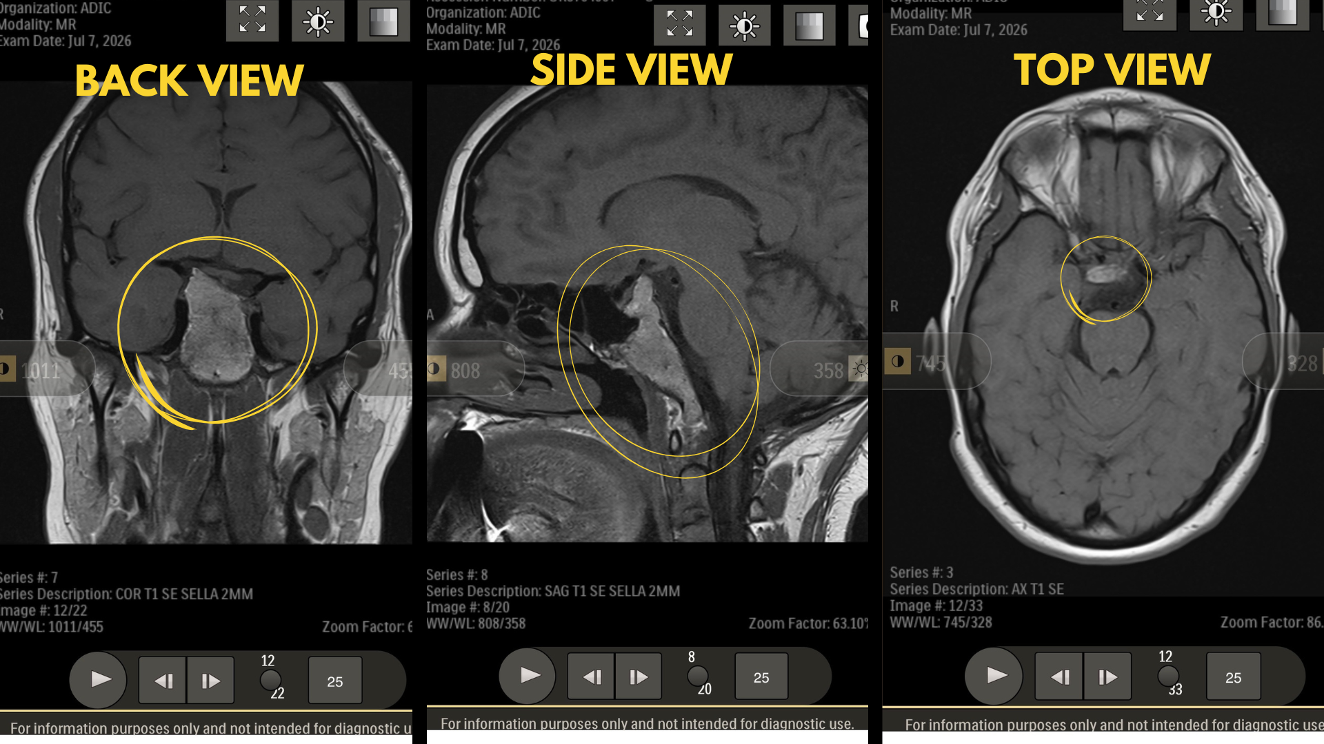 Help Samantha Access Specialized Skull Base Tumor Care campaign photo, 7 of 8