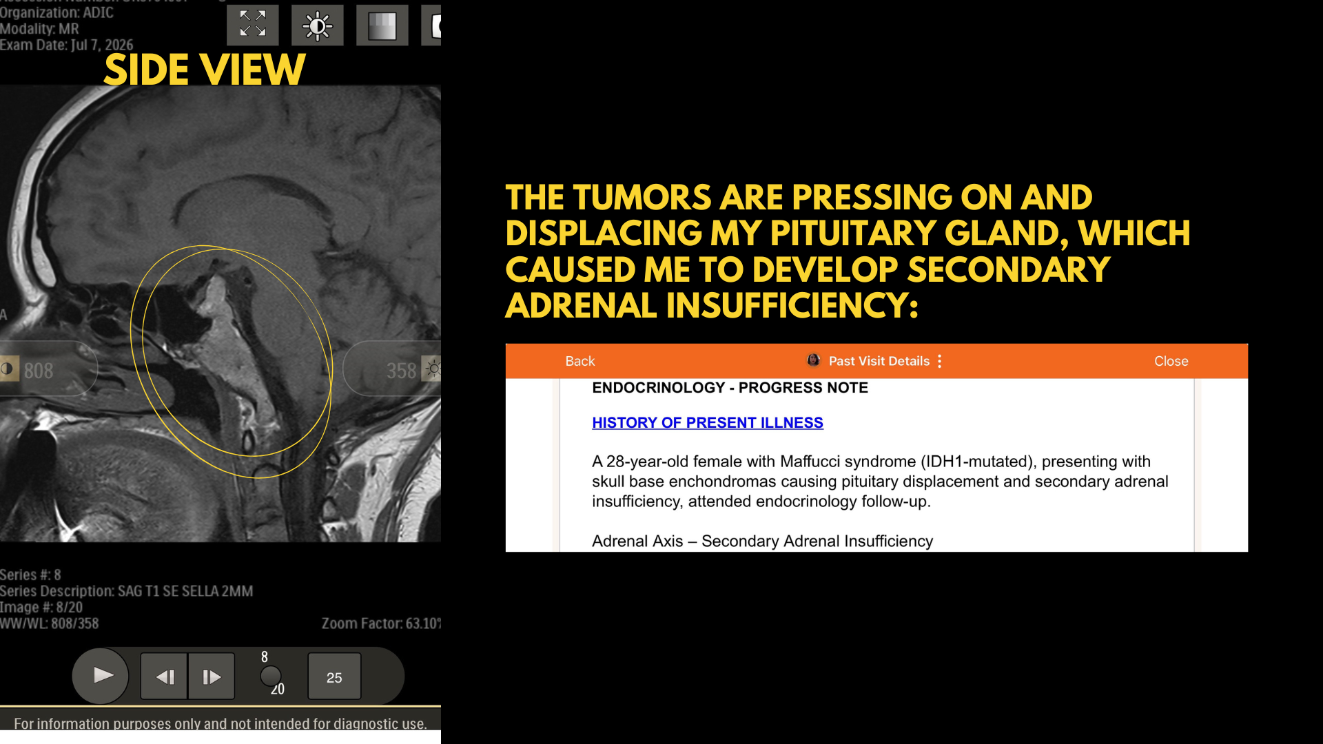 Help Samantha Access Specialized Skull Base Tumor Care campaign photo, 2 of 8