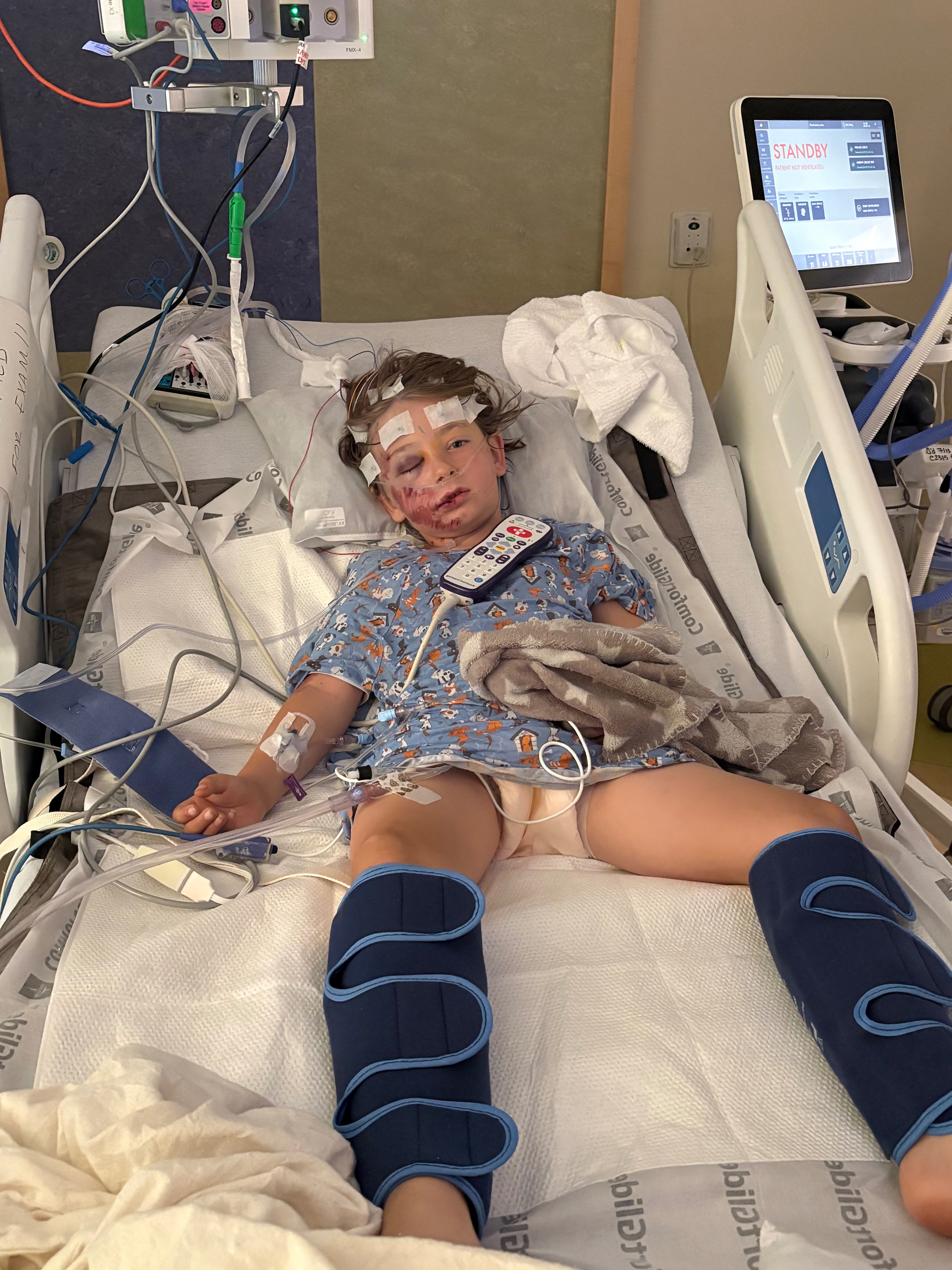 Support Neighbor's Son After Bike Park Accident campaign photo, 4 of 5