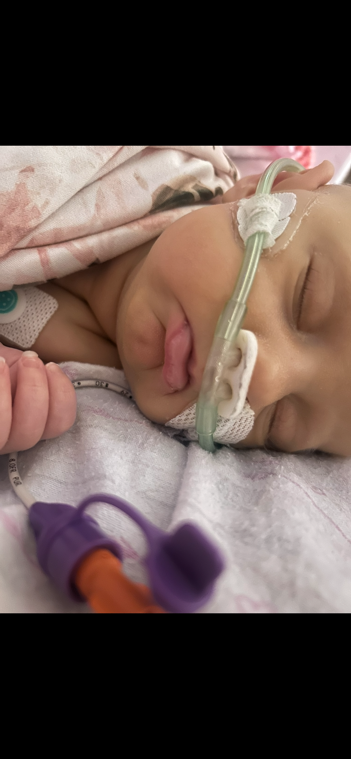 Donate to baby Isabelle Mae’s journey to recovery. campaign photo, 5 of 8