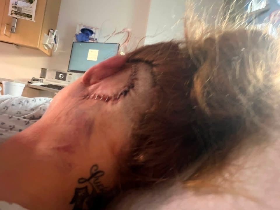 Support Christen After Accident and Surgery campaign photo, 7 of 8