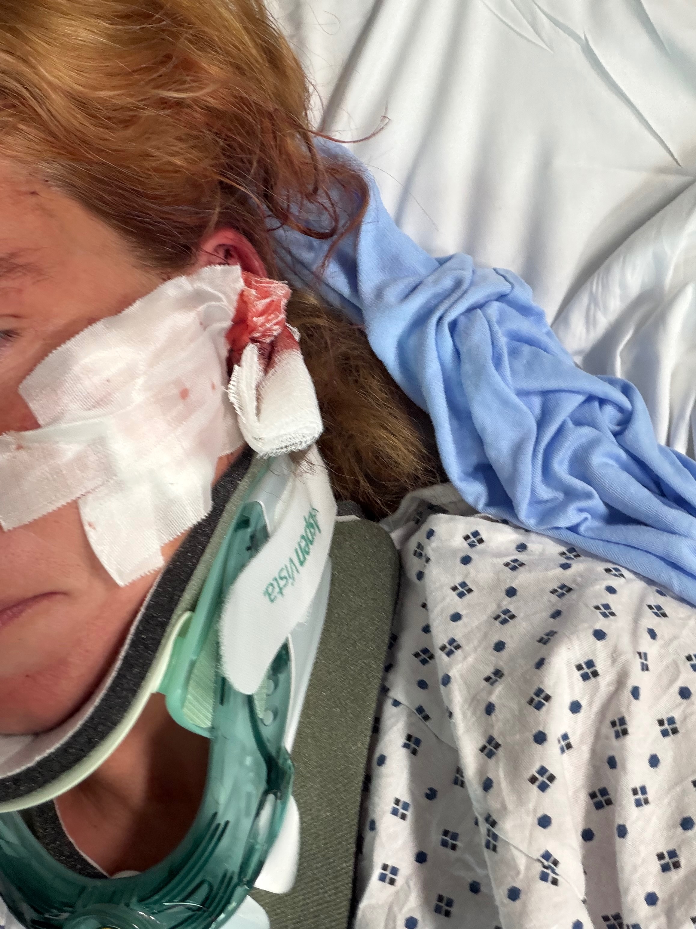 Support Christen After Accident and Surgery campaign photo, 6 of 8