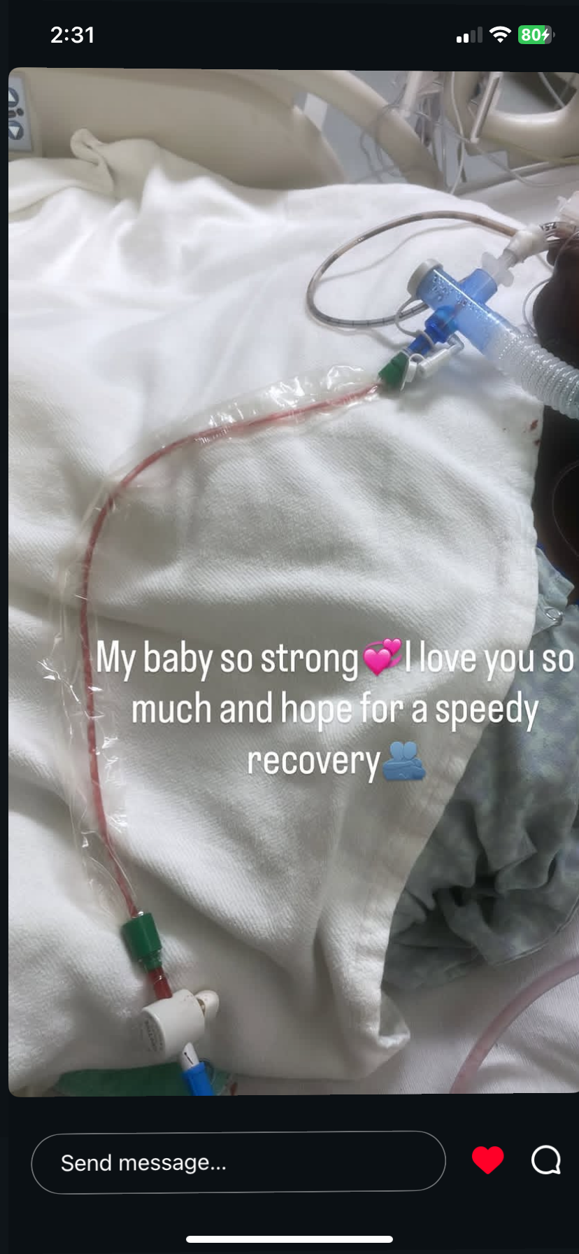Help lamarion Recover After Accident campaign photo, 2 of 8