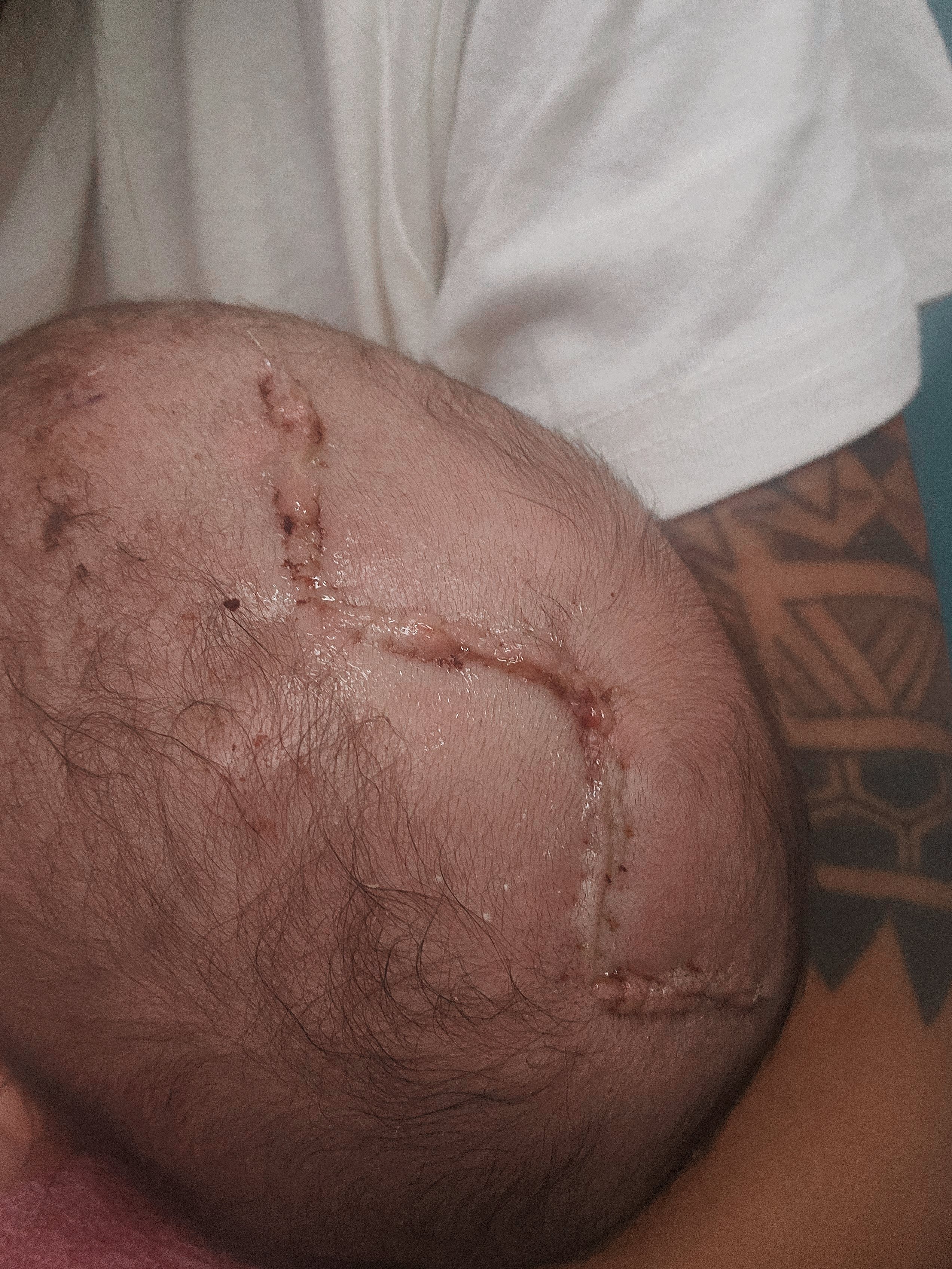 Photo de la campagne Help Baby Ezrielle Through Two Life-Changing Surgeries ❤️, 2 sur 8