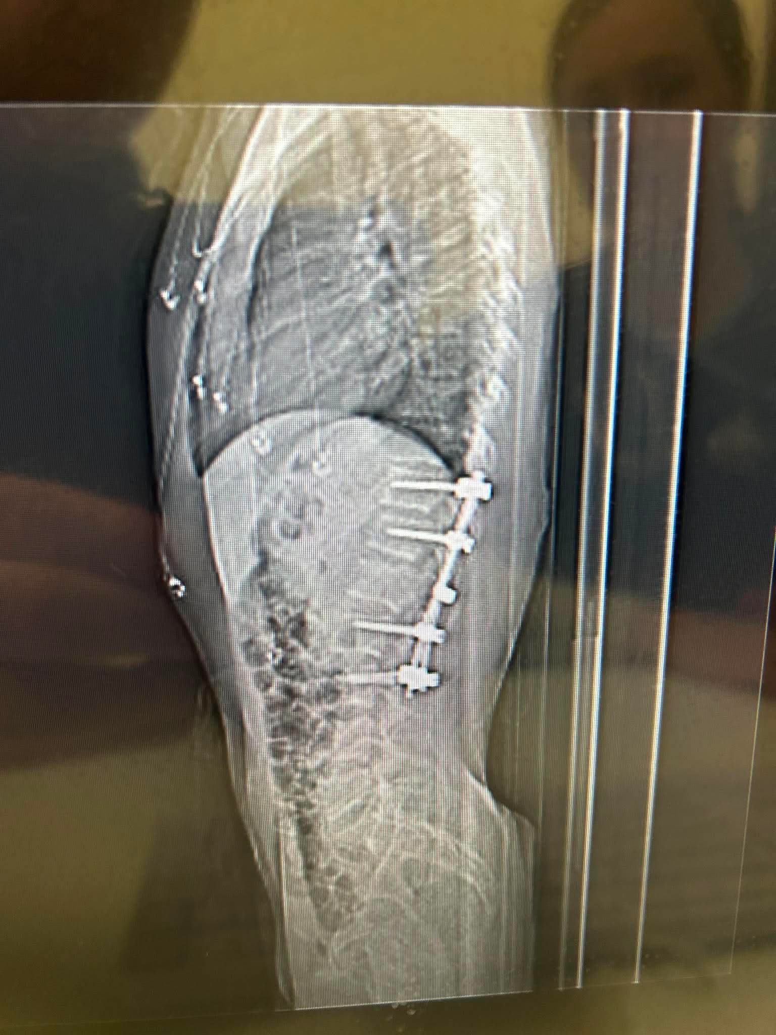 Ethan’s Road to Recovery campaign photo, 6 of 7