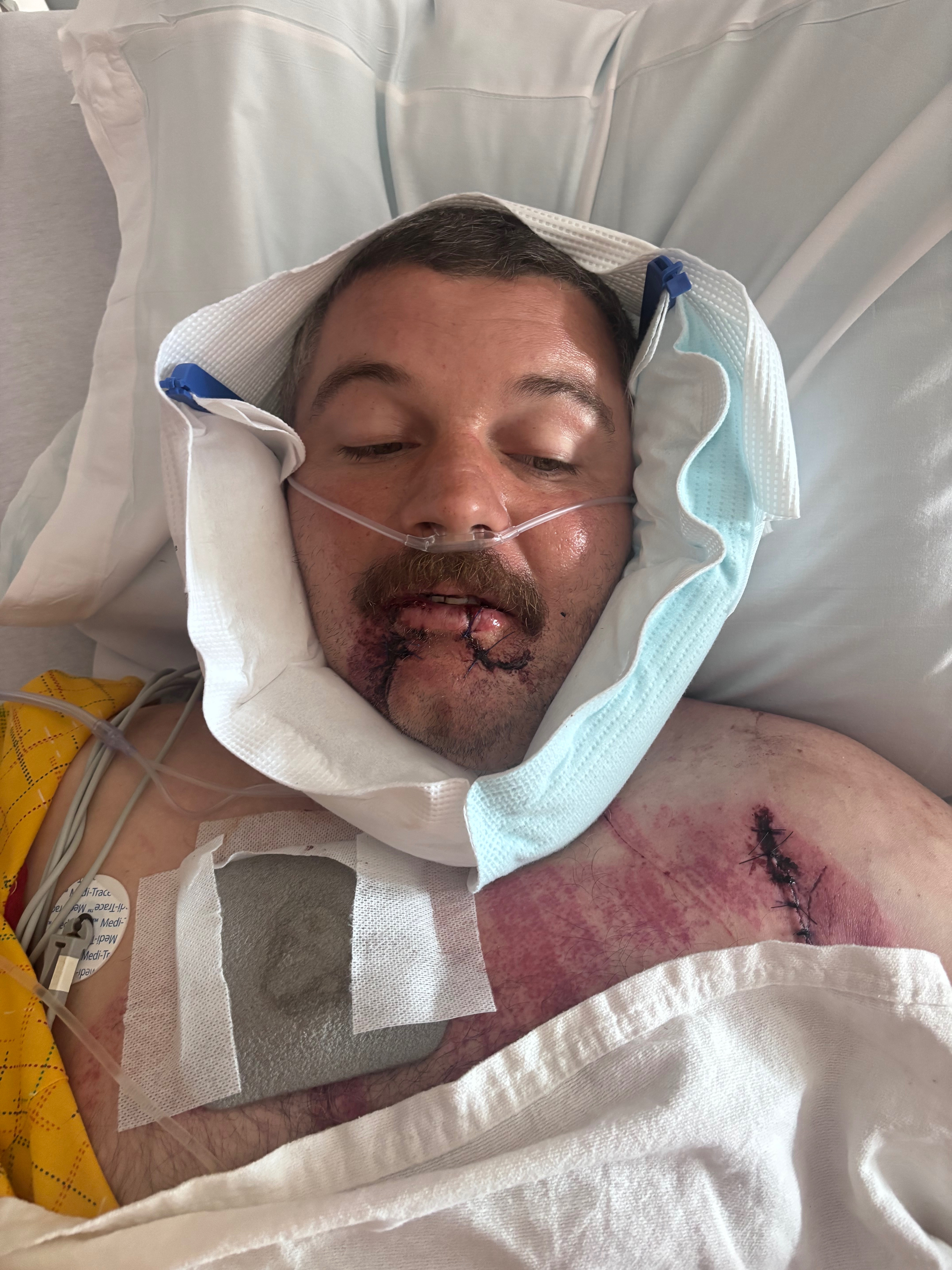 Daniel’s Road to Recovery After Hit-and-Run campaign photo, 2 of 7