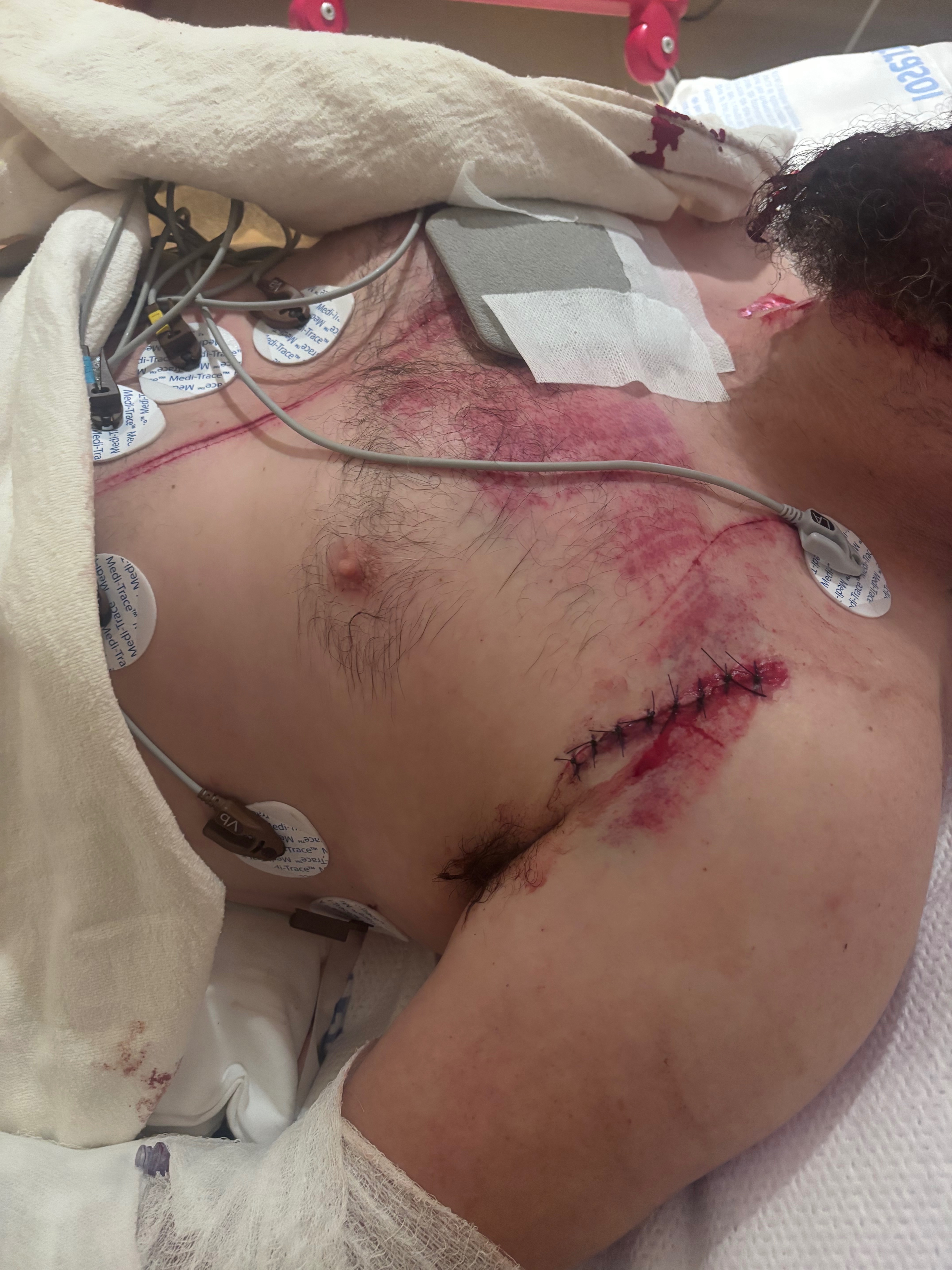 Daniel’s Road to Recovery After Hit-and-Run campaign photo, 5 of 7