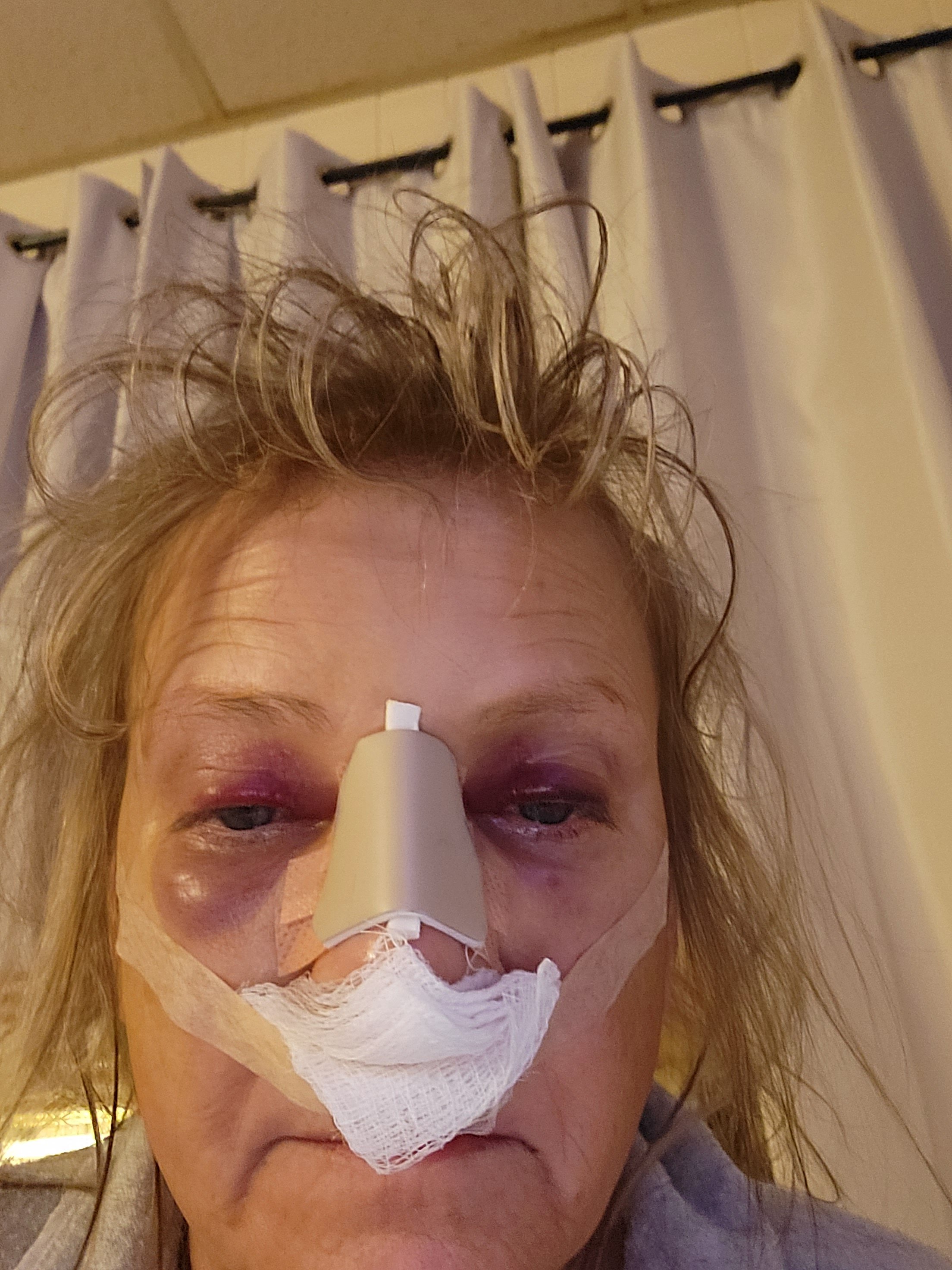 Kathy's Journey to Walk Again After Coma campaign photo, 7 of 8