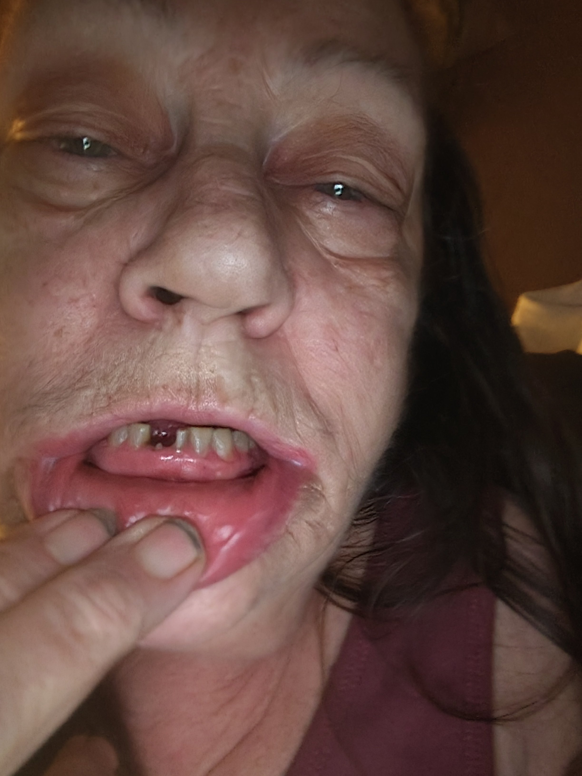 Help me Please! No cavities. My teeth are crumblin campaign photo, 12 of 13