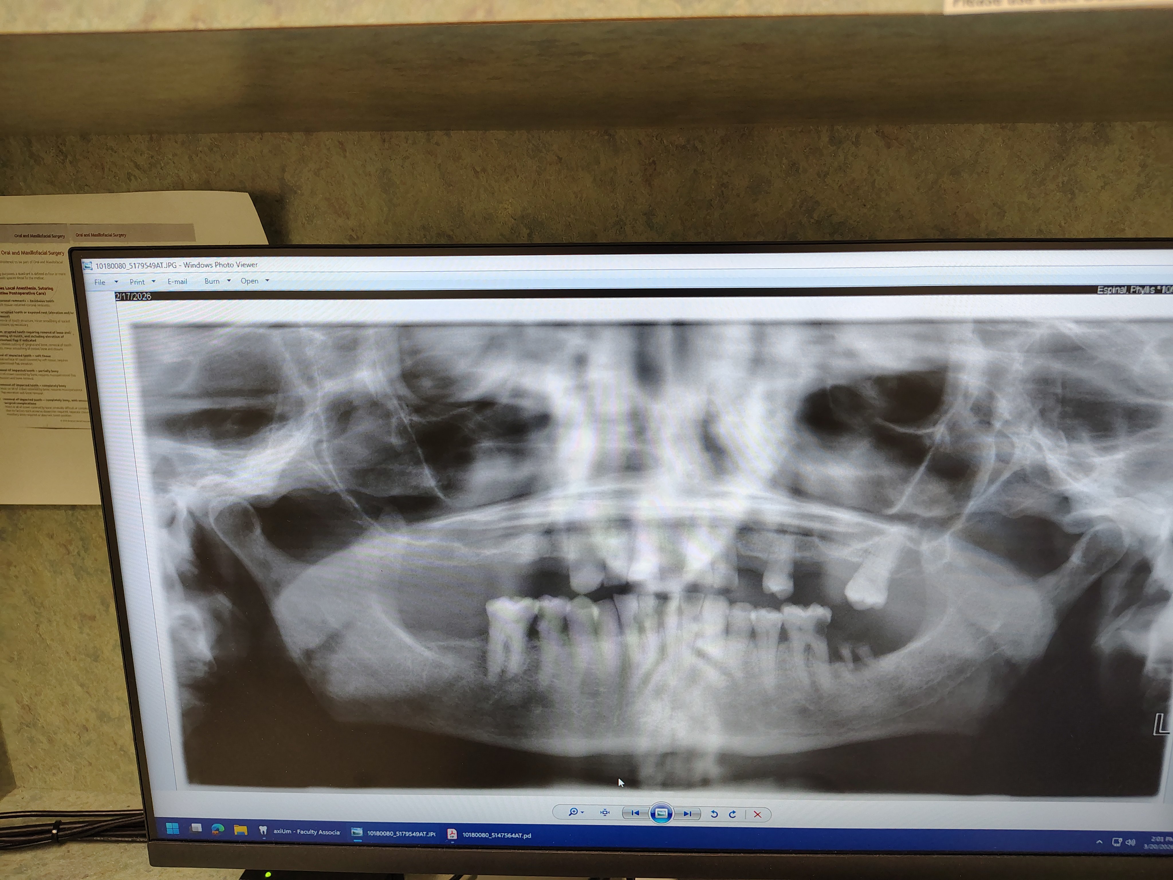 Help me Please! No cavities. My teeth are crumblin campaign photo, 2 of 13