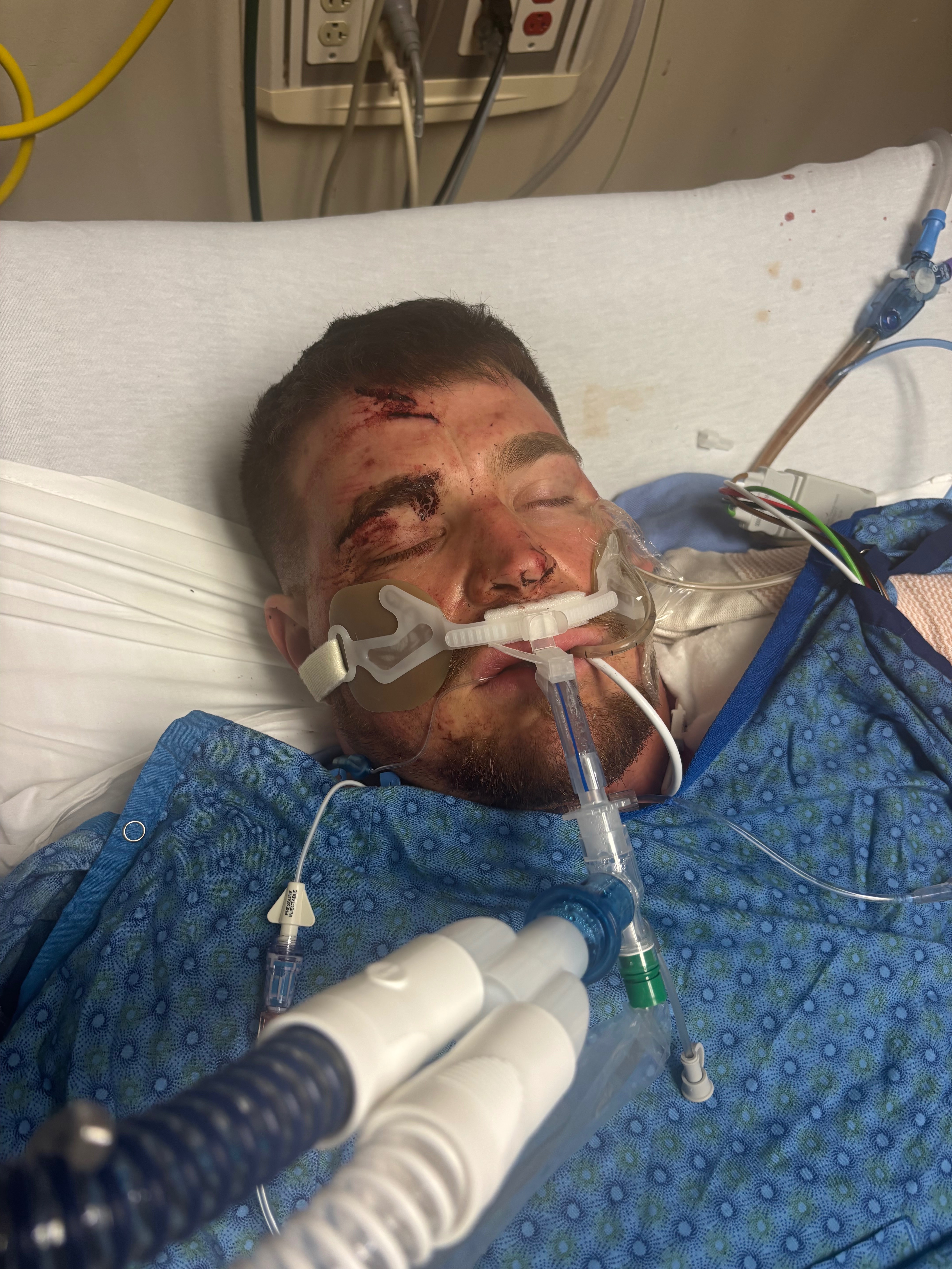 Help Me Get Back on My Feet after Devastating Accident campaign photo, 2 of 8