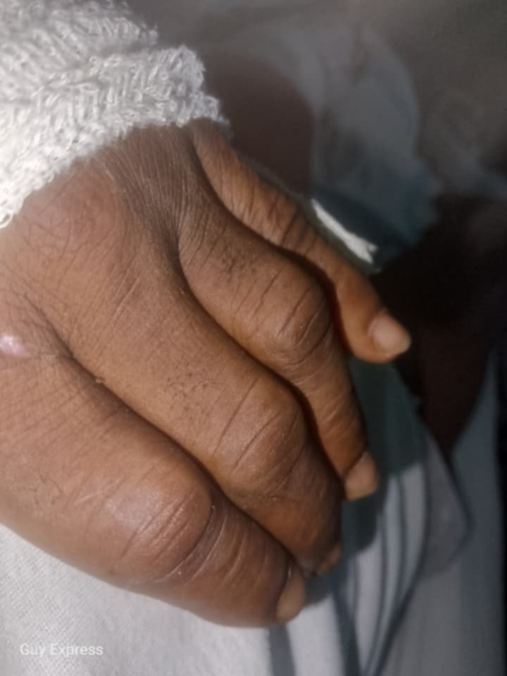 Help Guy Walk Again After Haiti Accident campaign photo, 6 of 7