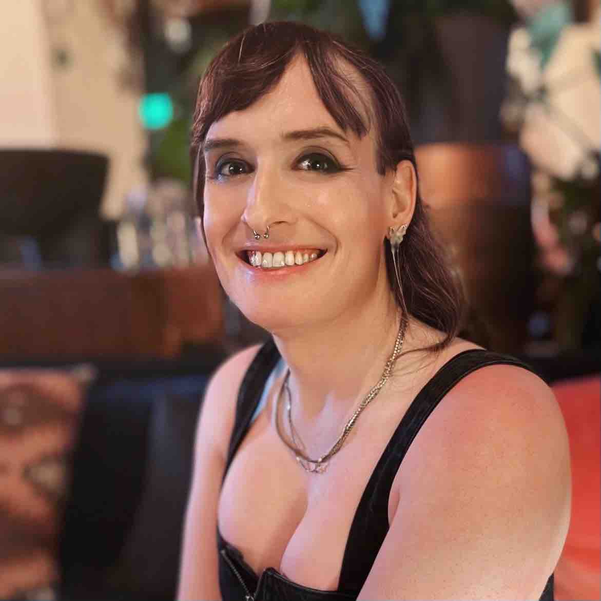 Support Sage's Facial Feminization Surgery campaign photo, 7 of 8