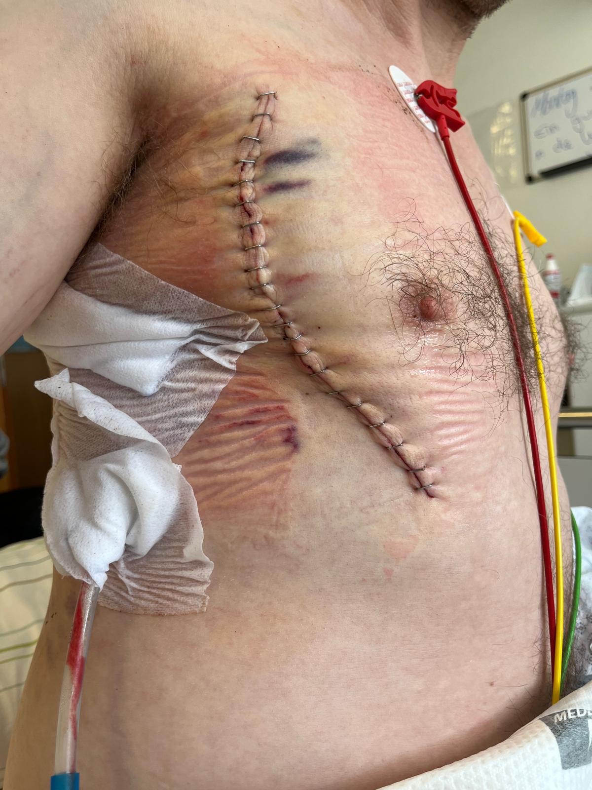 Kampagnen-Foto für Hilf Sebastian nach dem Anschlag auf den Berliner CSD, 2 von 6