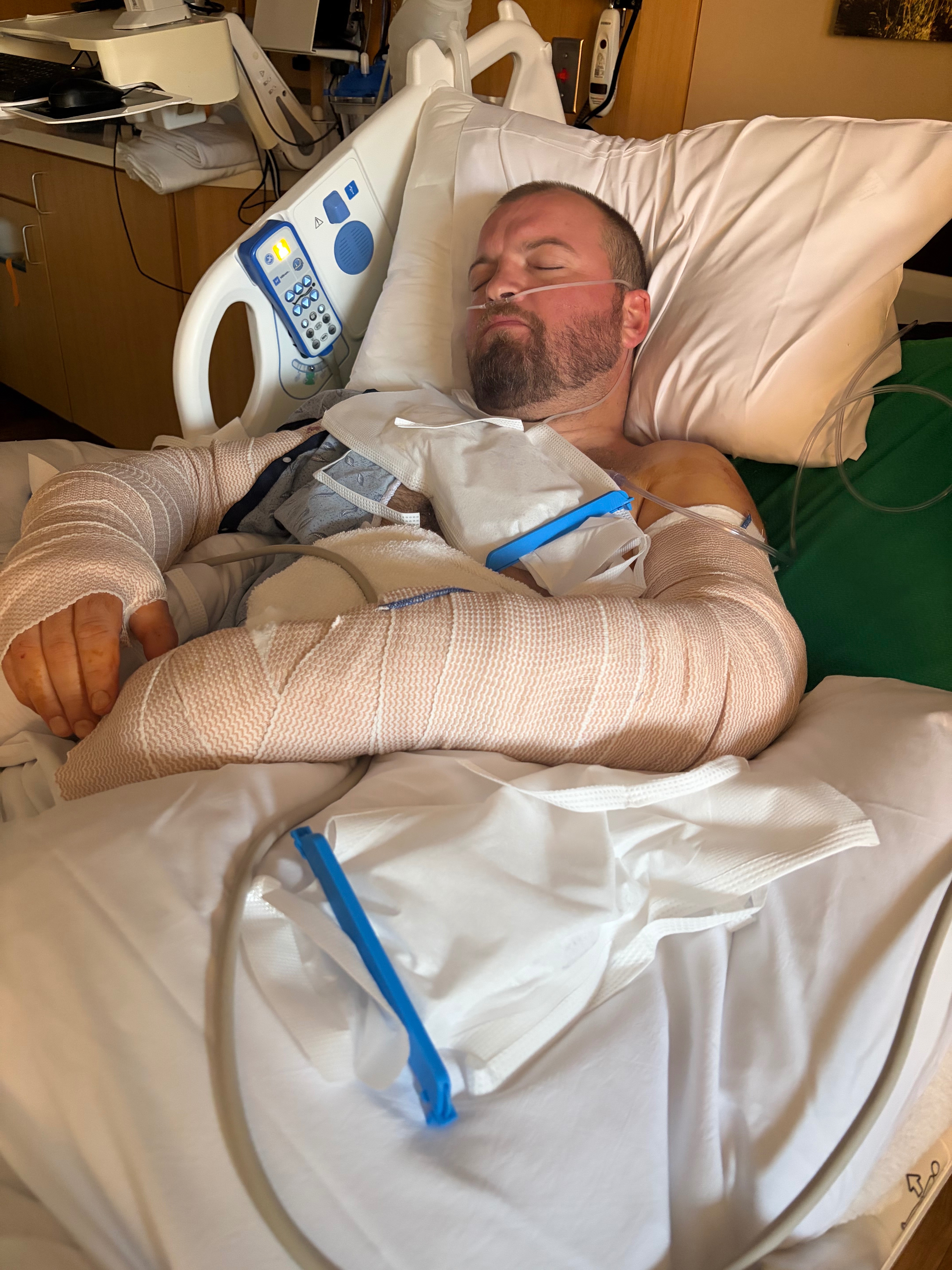 Support Joshua Hixon’s recovery after Pitbull attack! campaign photo, 2 of 9