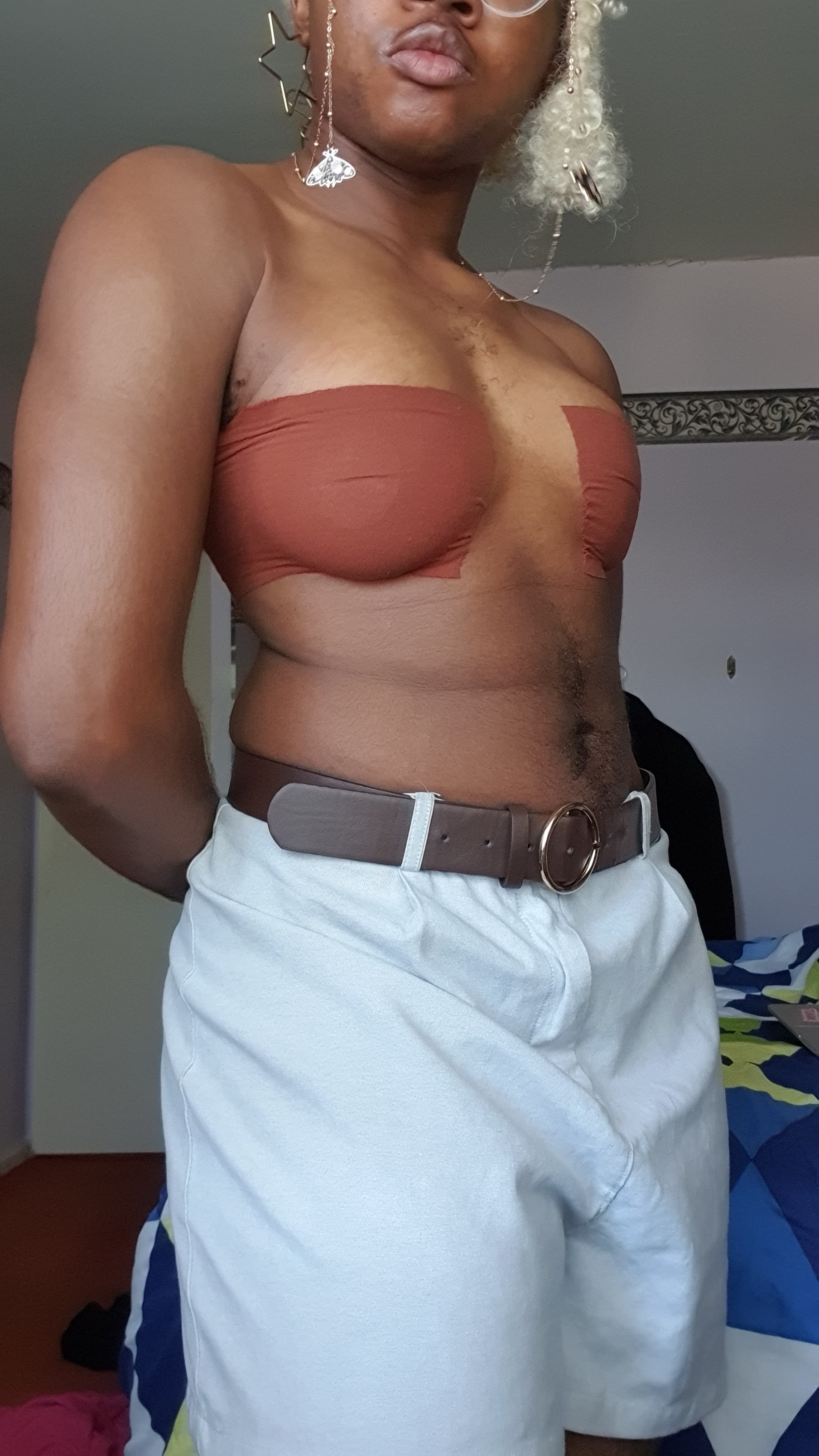 Sol's Gender Affirming Surgery Fund! campaign photo, 6 of 7