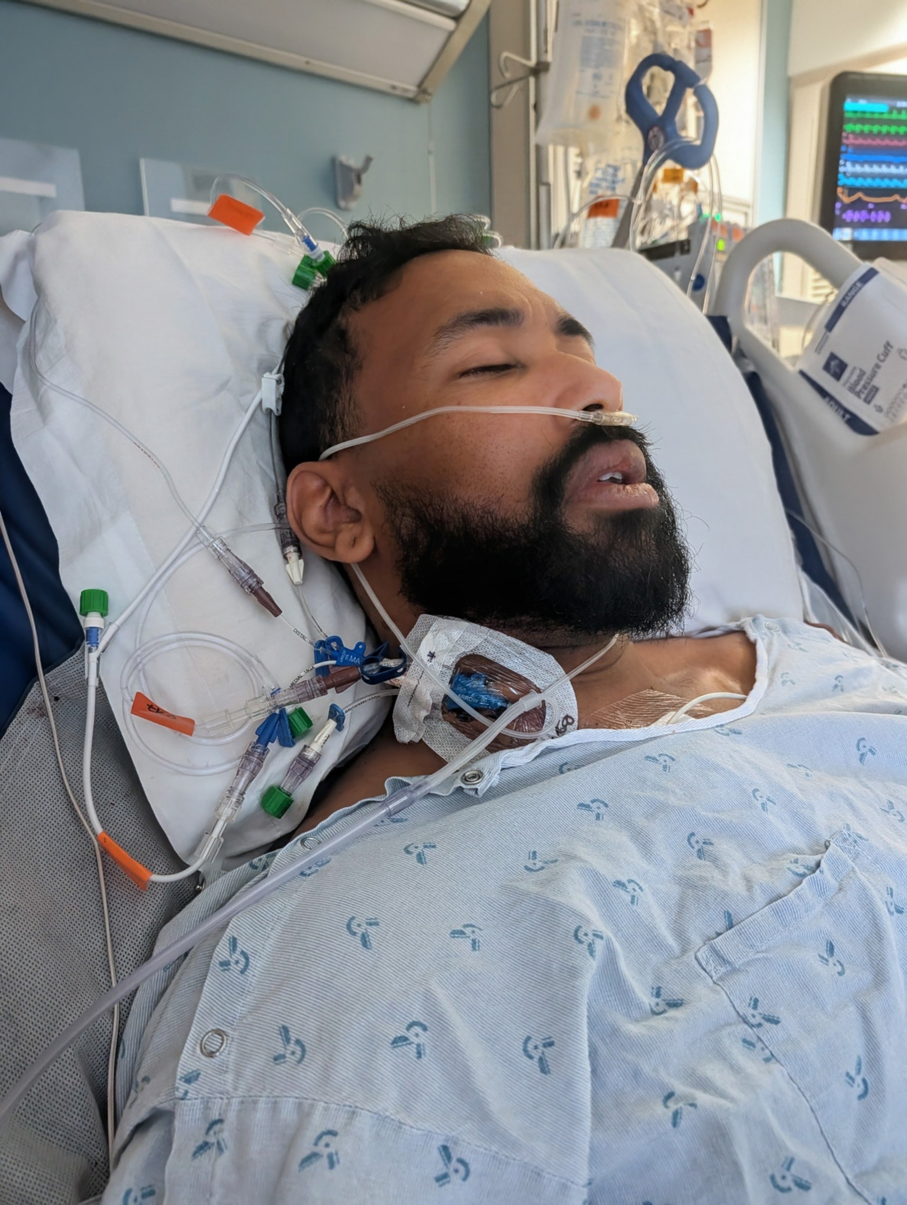Help Corn Heal After Life-Saving Surgery campaign photo, 8 of 11
