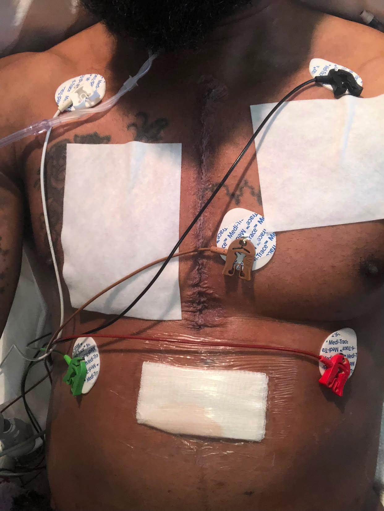 Help Corn Heal After Life-Saving Surgery campaign photo, 9 of 11