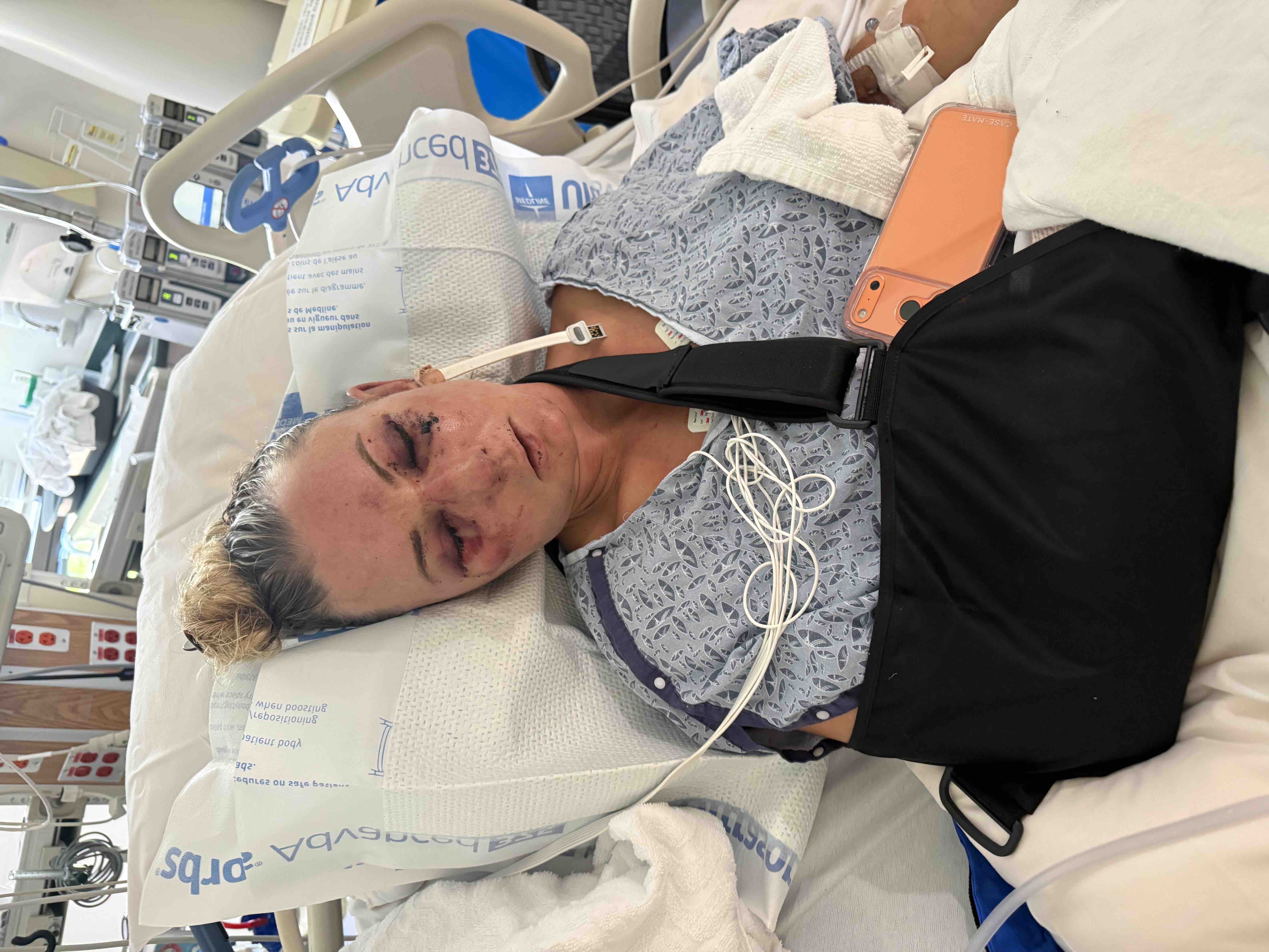 Help Hannah Recover and Rebuild Her Life campaign photo, 2 of 5