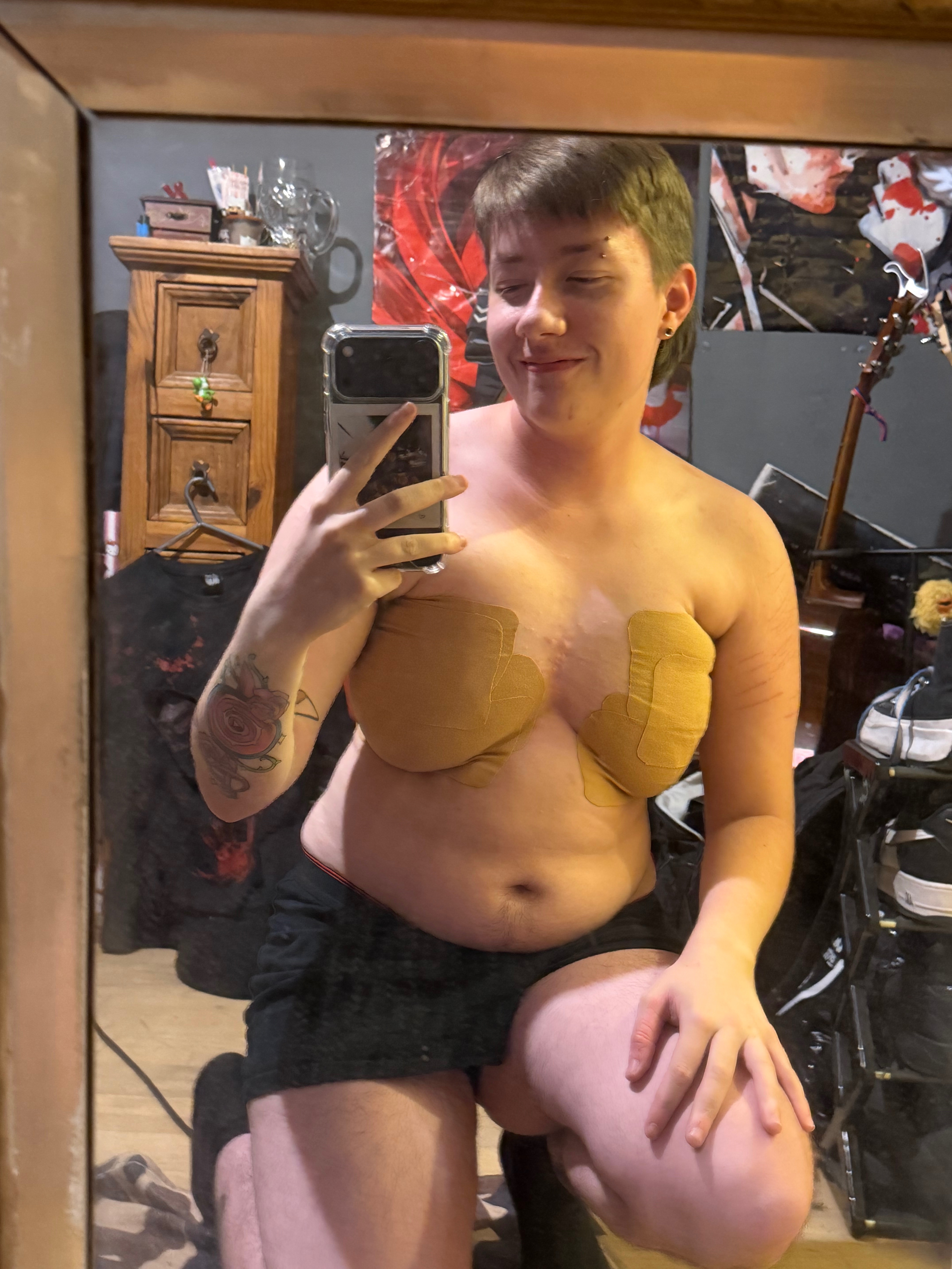 Help raise funds for my top surgery! campaign photo, 2 of 6