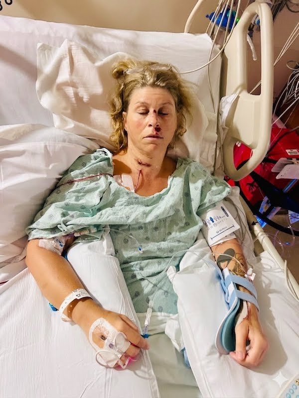 Hope and Healing for Kimi's Recovery campaign photo, 2 of 8
