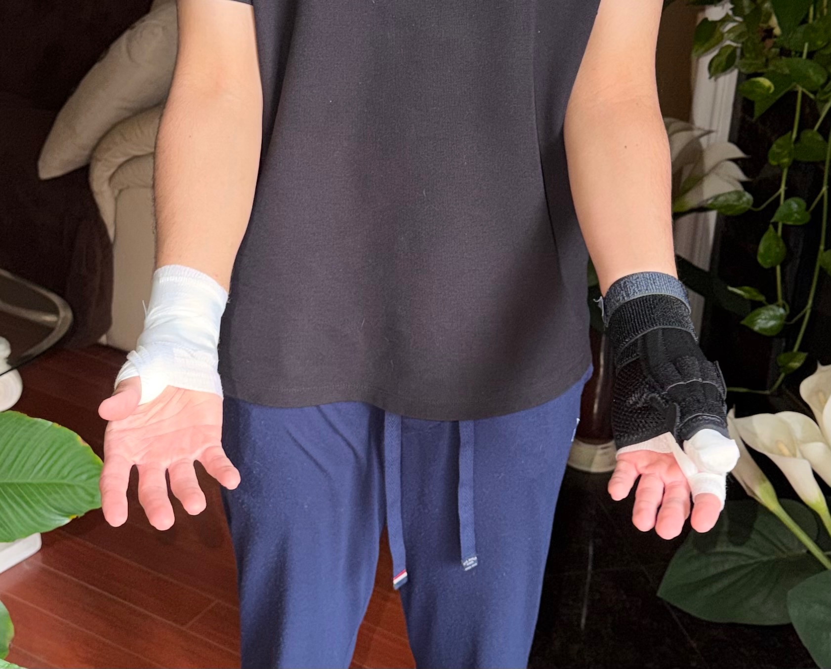 Help my Brother & our Yorkie recover after a pitbull attack campaign photo, 6 of 8
